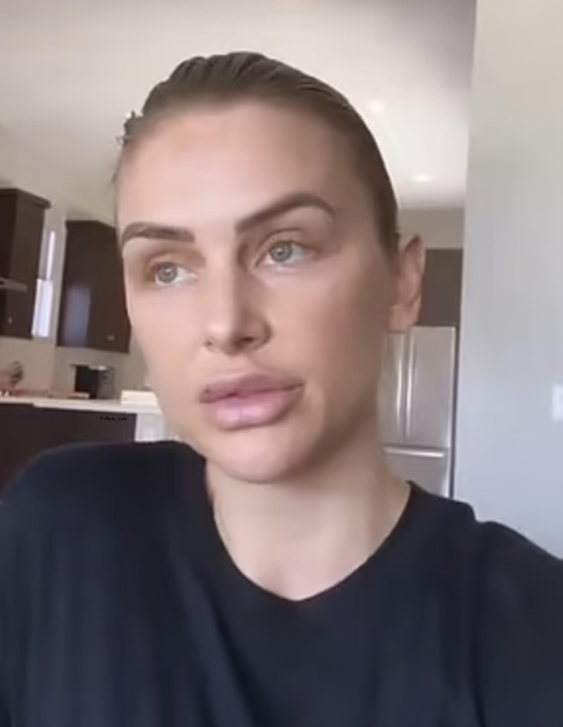 Lala Kent shows lip filler progress