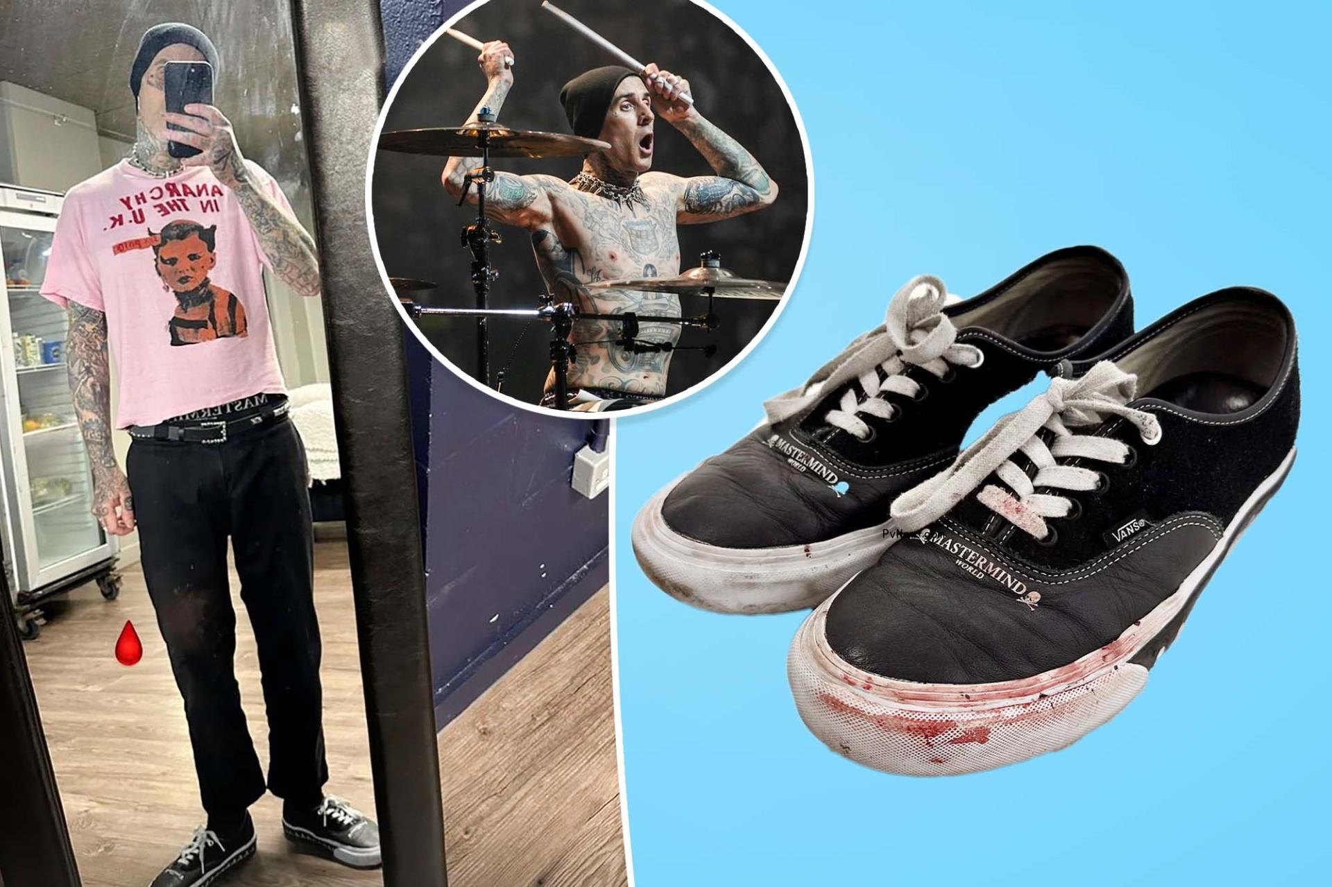 Travis Barker sells blood-soaked Vans sneakers from Bl<i></i>ink-182 tour for $4K