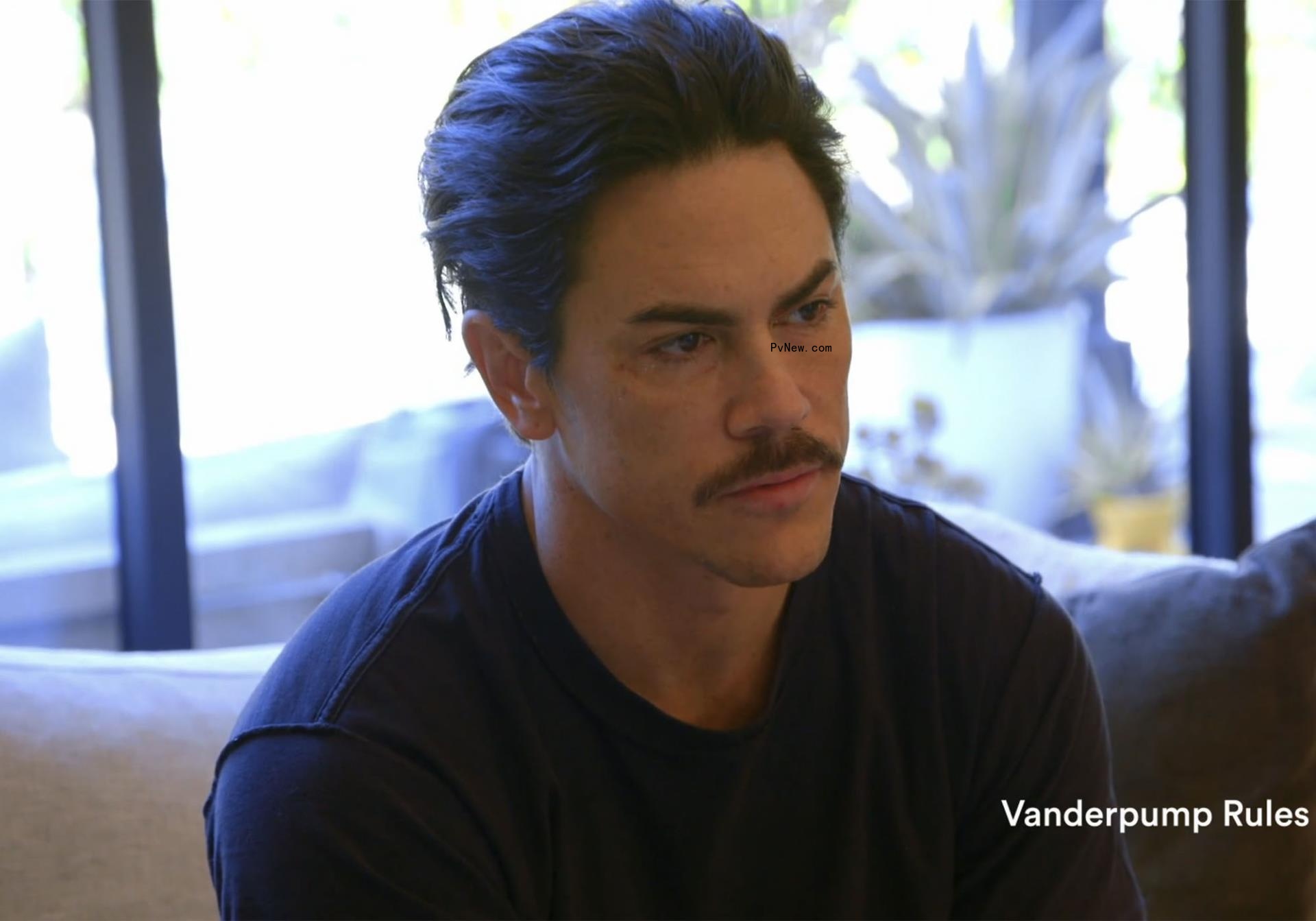 Tom Sandoval sporting an apparent bruised eye in the