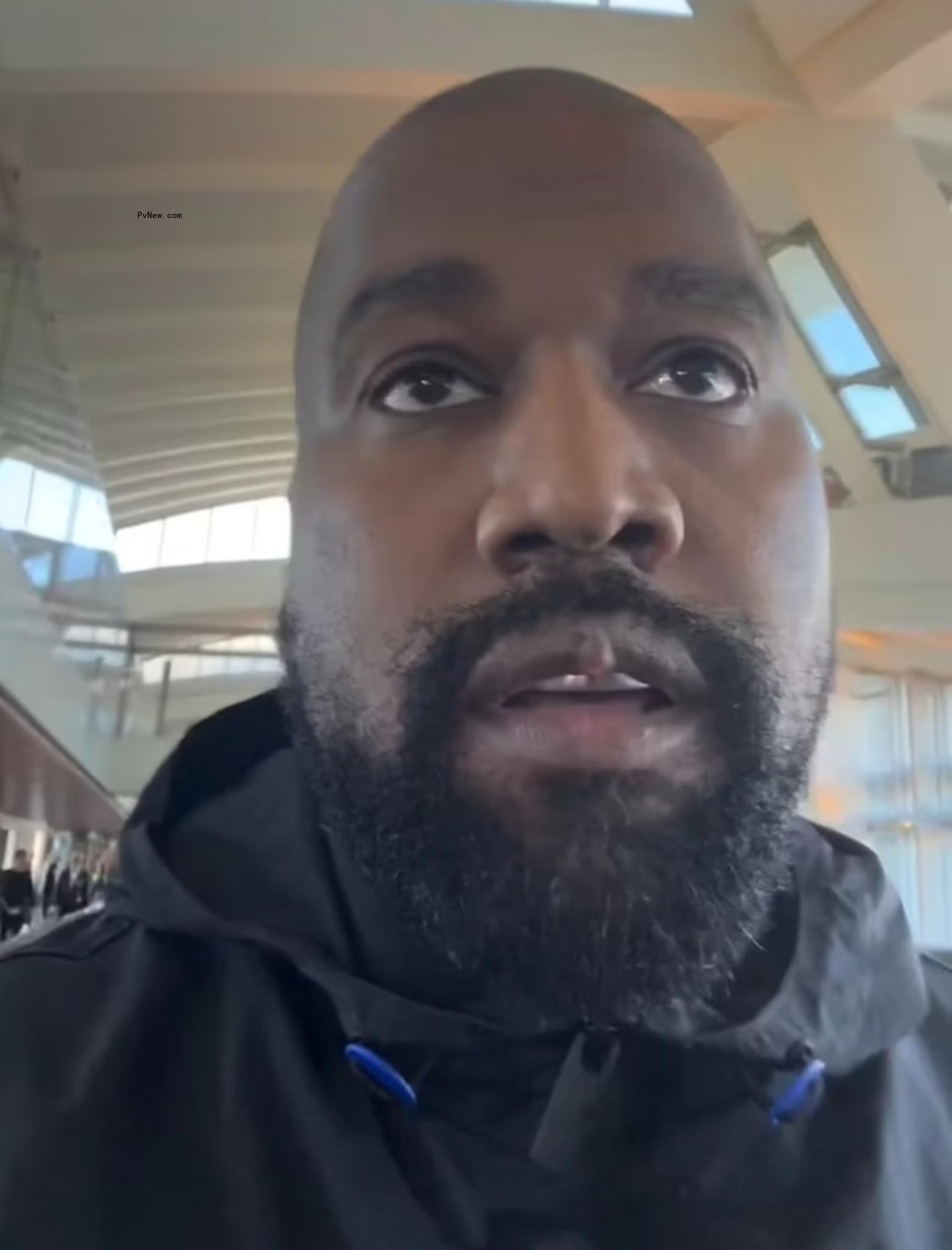 selfie of kanye west that highlights his upper lip bump
