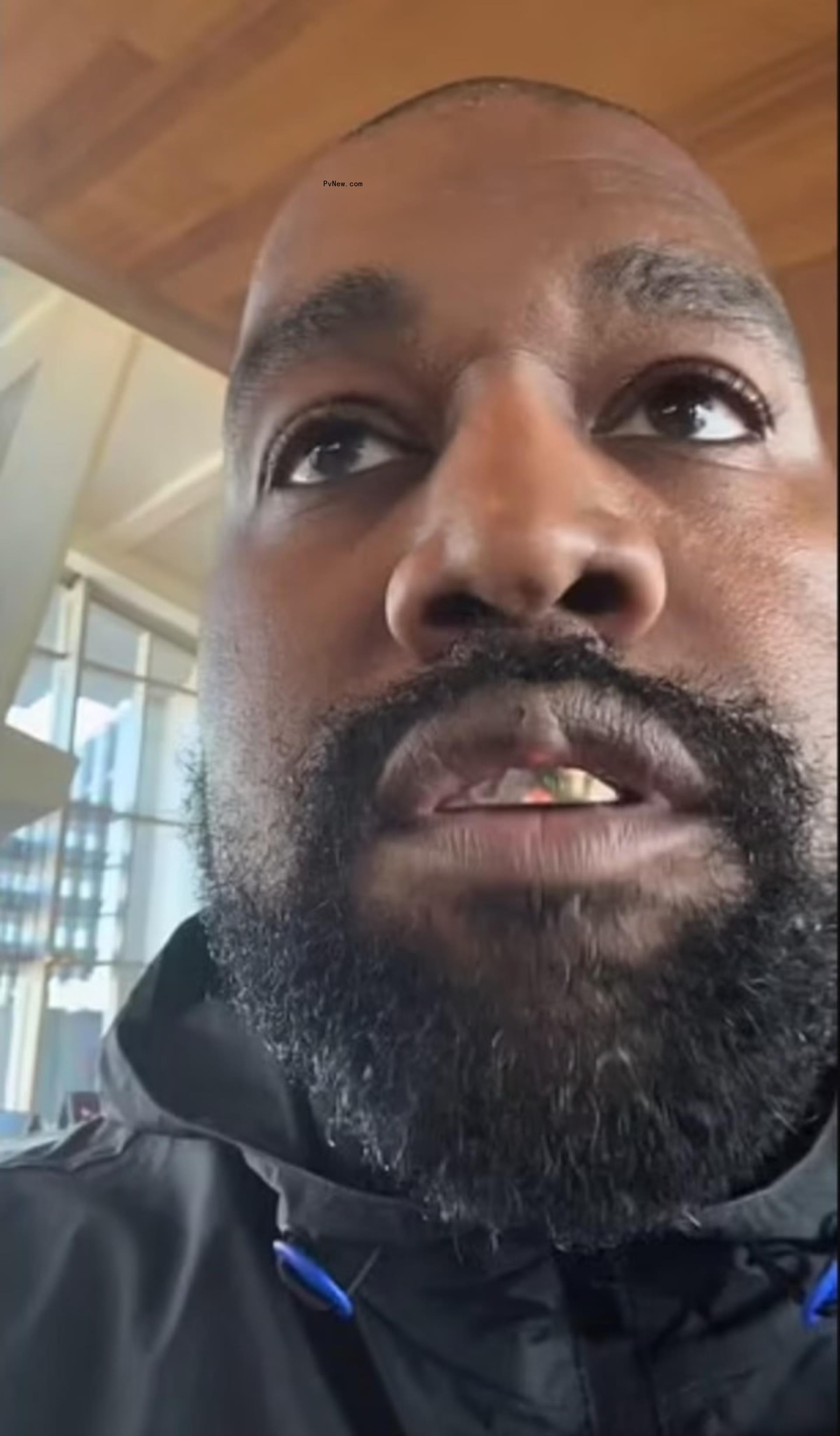close-up of kanye west's face that highlights his upper lip bump