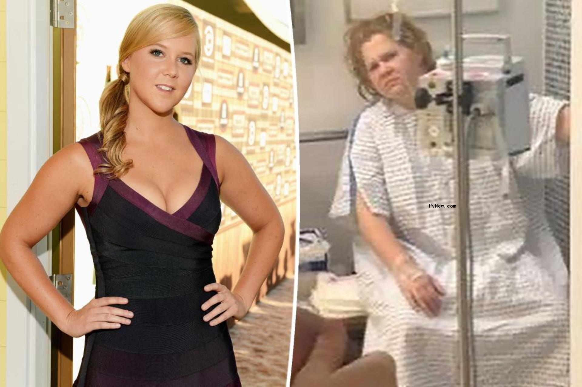 amy schumer