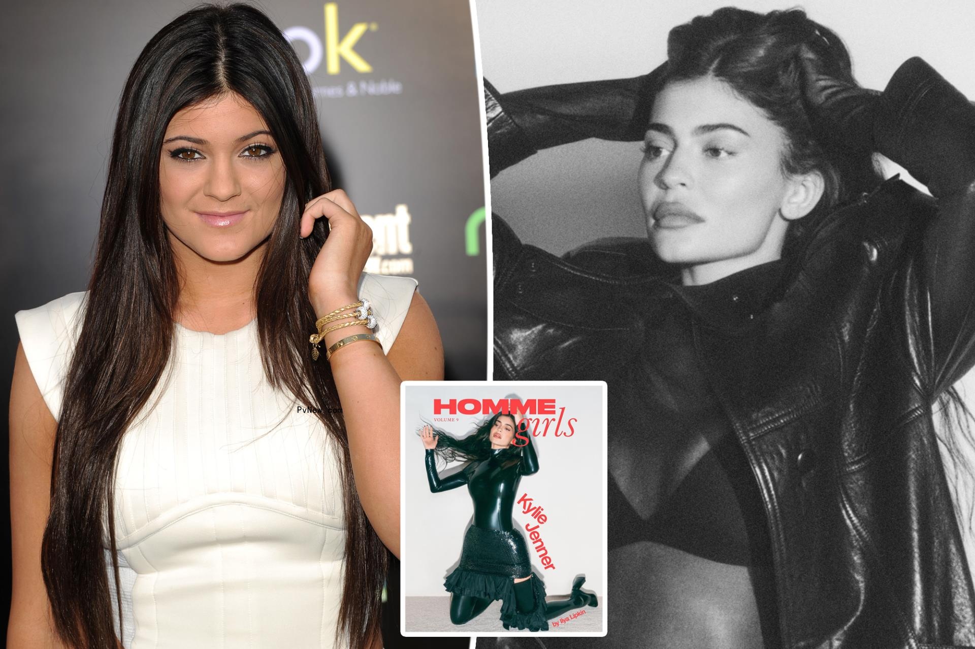 Kylie Jenner: It’s a ‘misconception’ that I’ve had ‘so much surgery on my face’