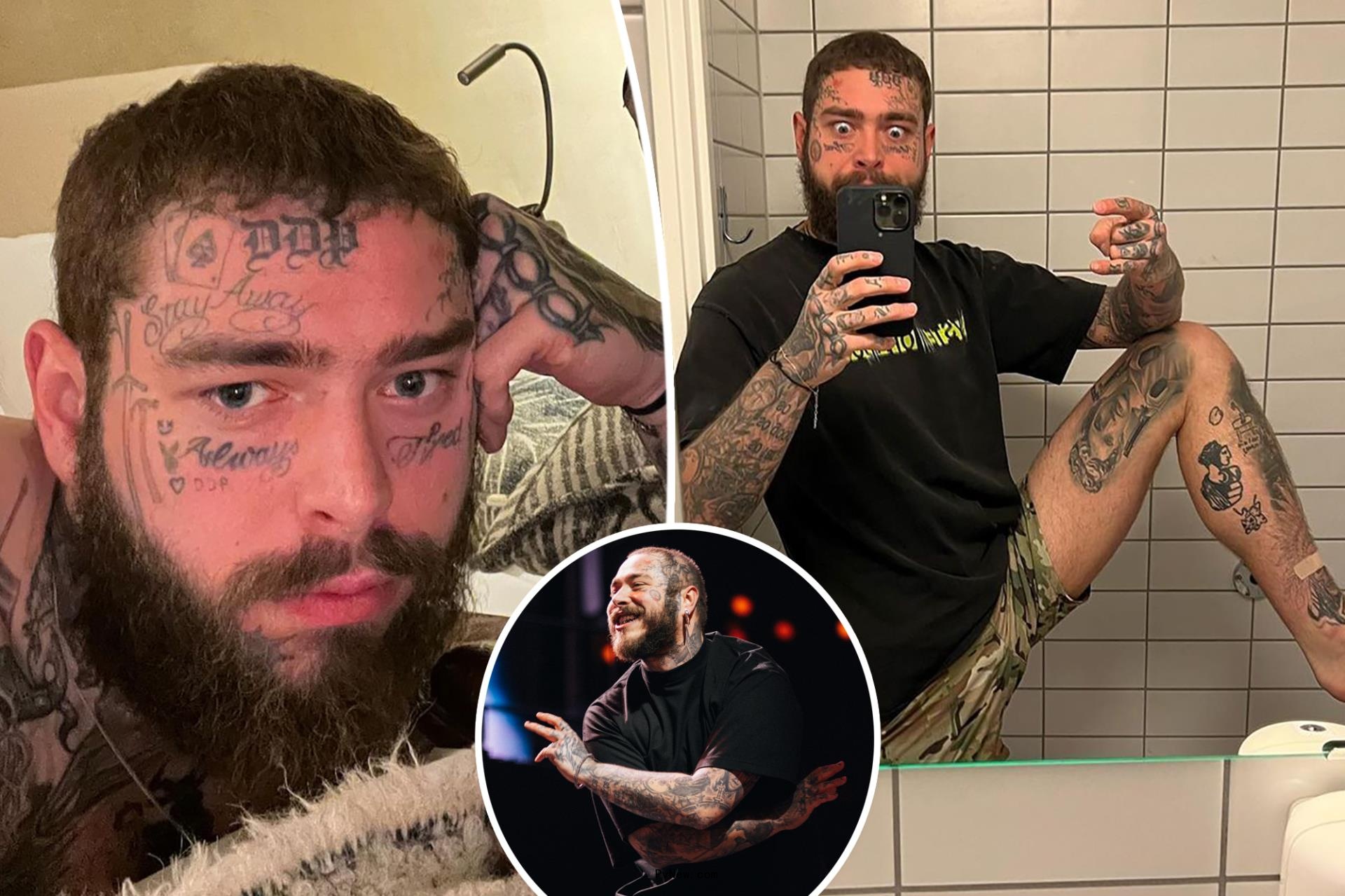 Post Malone denies drug use again amid co<i></i>ncerns a<i></i>bout his weight loss