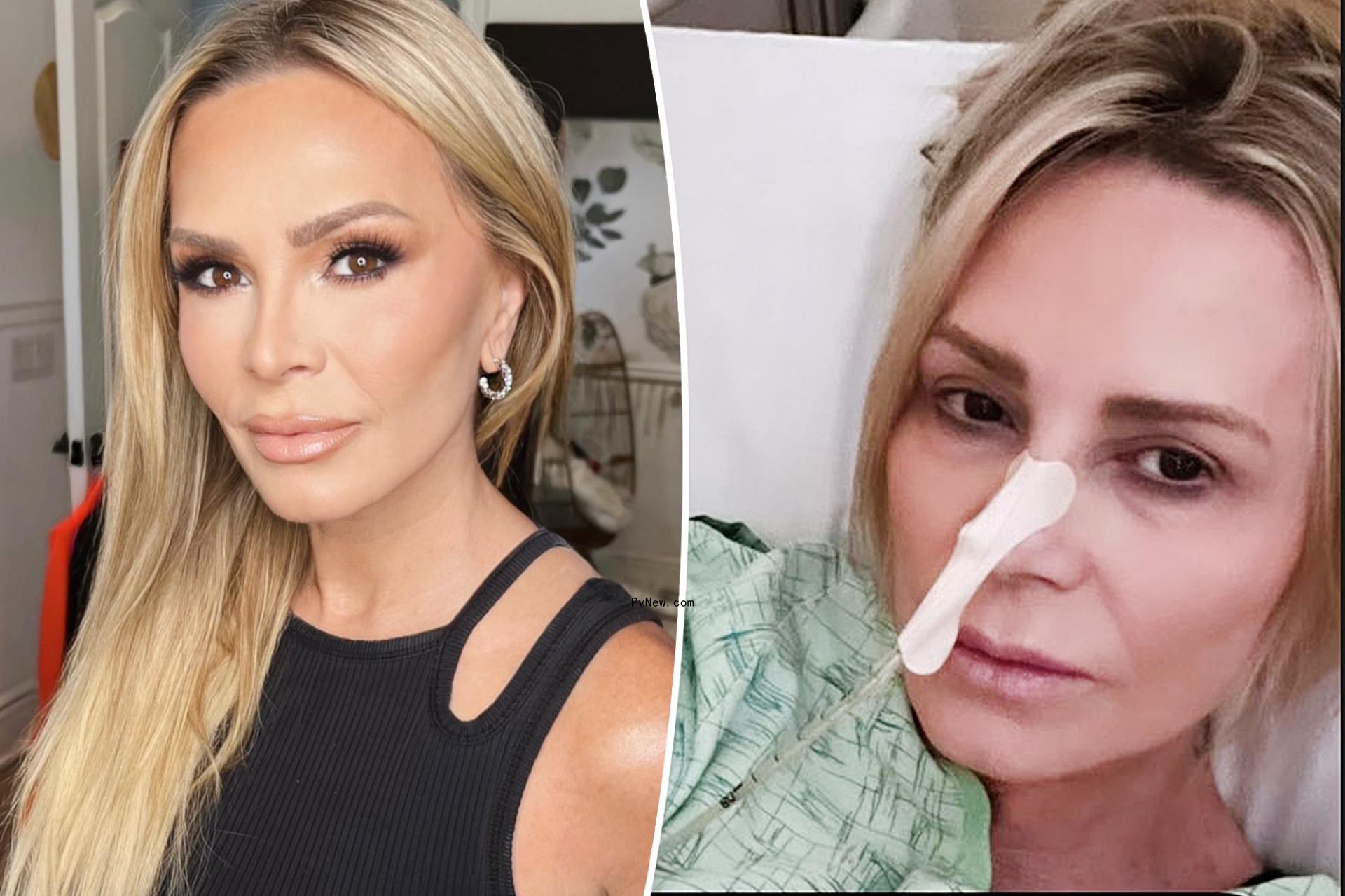 Tamra Judge hospitalized for intestinal obstruction, ‘praying’ she won’t need surgery