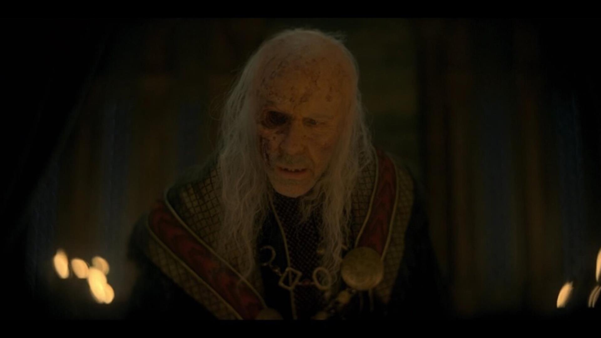 What’s Wrong With Viserys? ‘House of the Dragon’ Prosthetic Designer Explains His Flesh-Eating Disease and Making the Clickers in ‘The Last of Us’