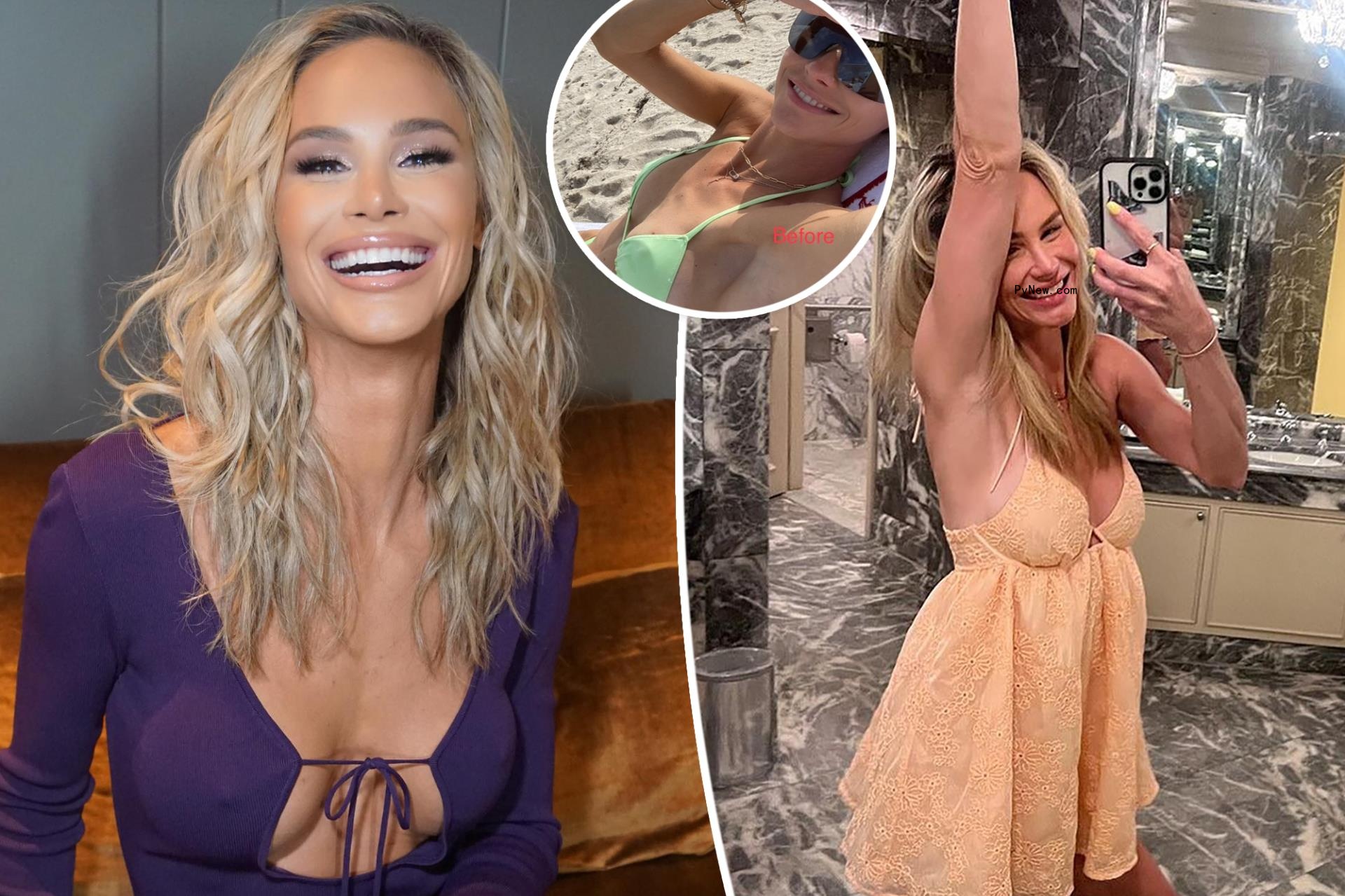 Meghan King celebrates ‘anniversary’ of ‘magic’ nose and boob jobs in sexy snaps