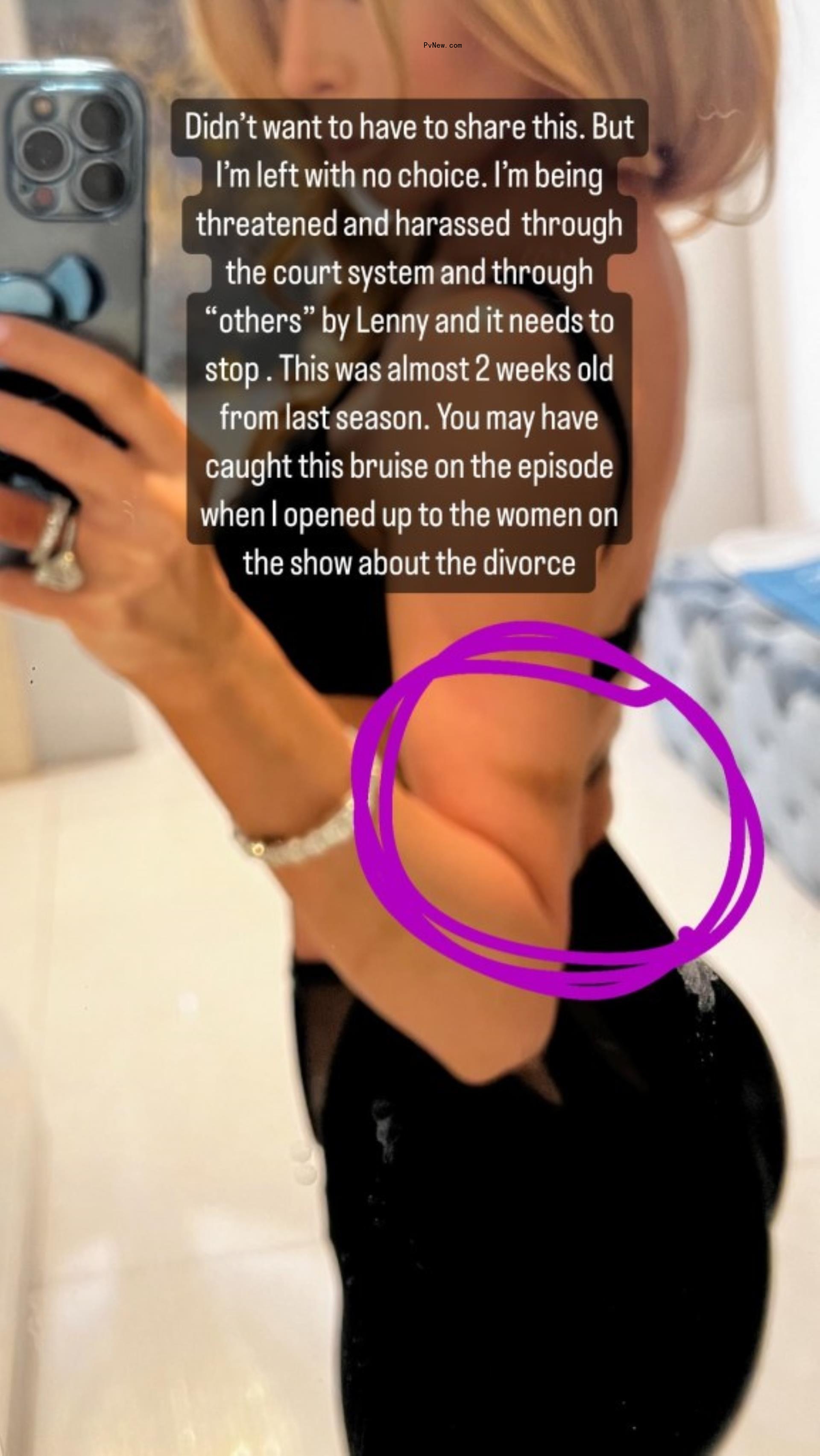 lisa hochstein mirror selfie with a purple circle around what could be a bruise