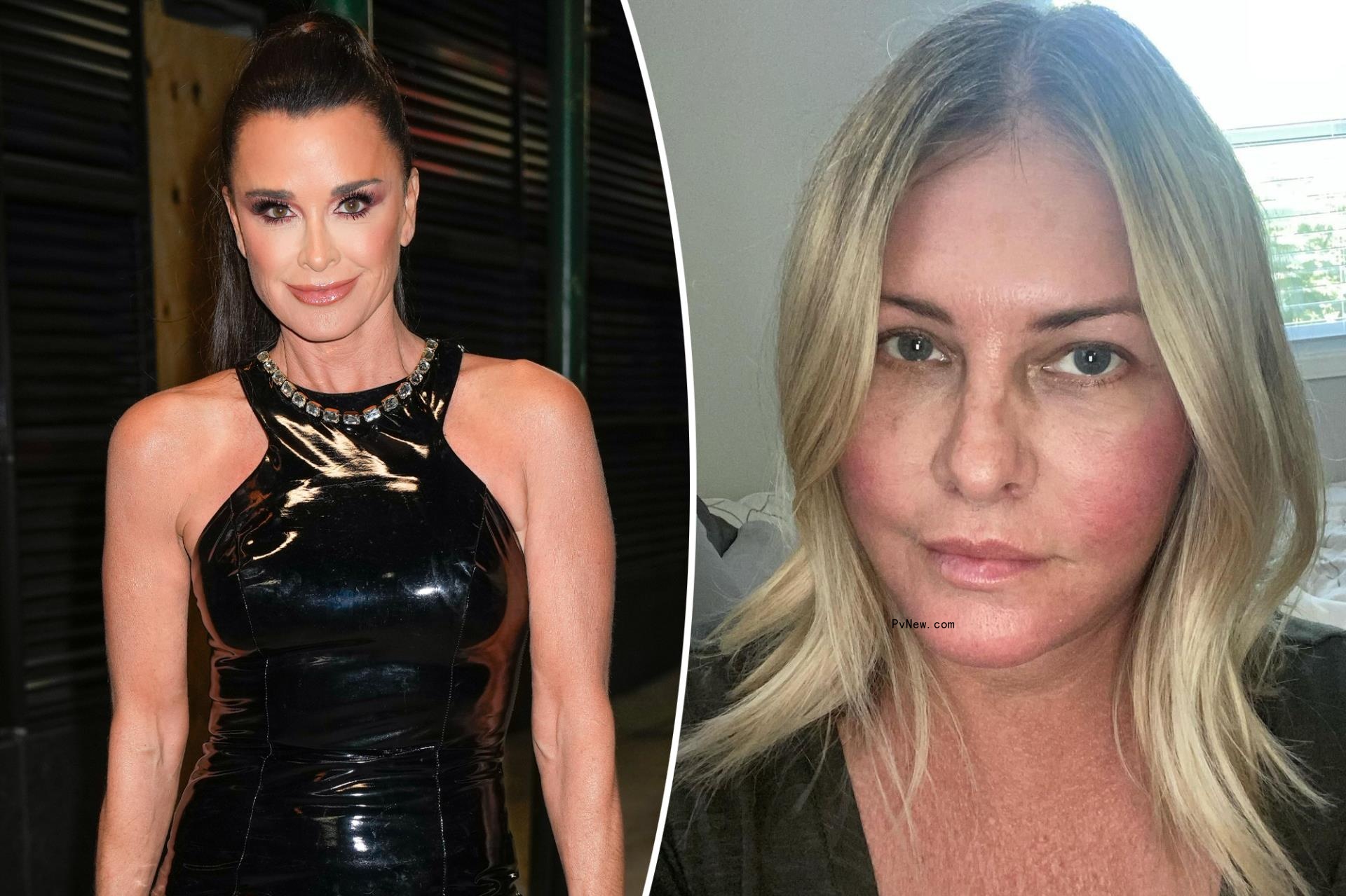 Kyle Richards do<i></i>nates $1K to ‘Baywatch’ alum Nicole Eggert’s breast cancer battle