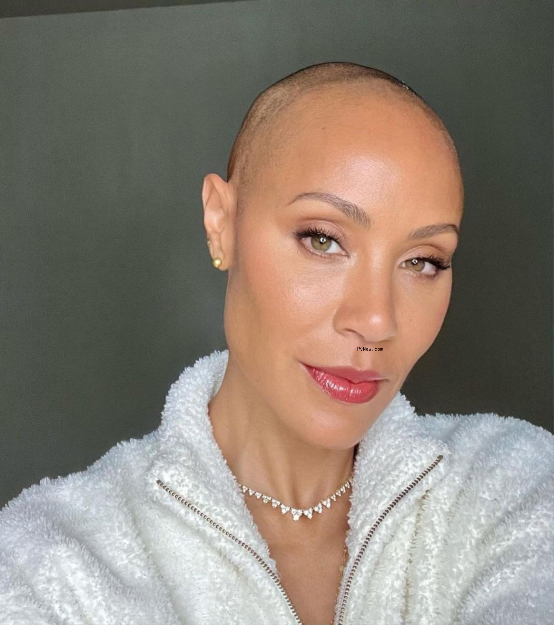 Jada Pinkett Smith has issued an update on her battle with alopecia, revealing that her hair is trying to