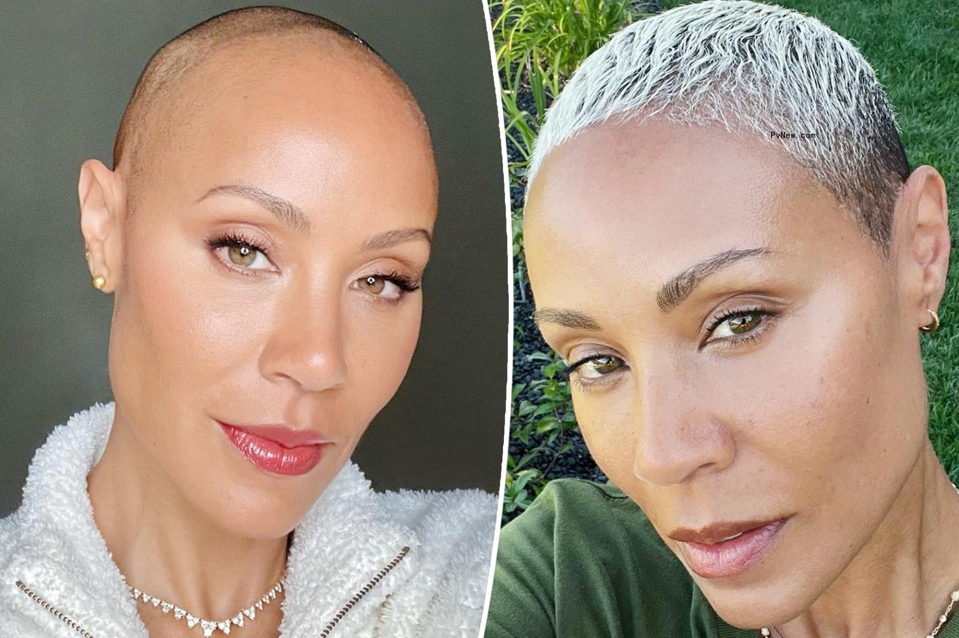 Jada Pinkett Smith shares photo of her hair’s ‘comeback’ after alopecia diagnosis
