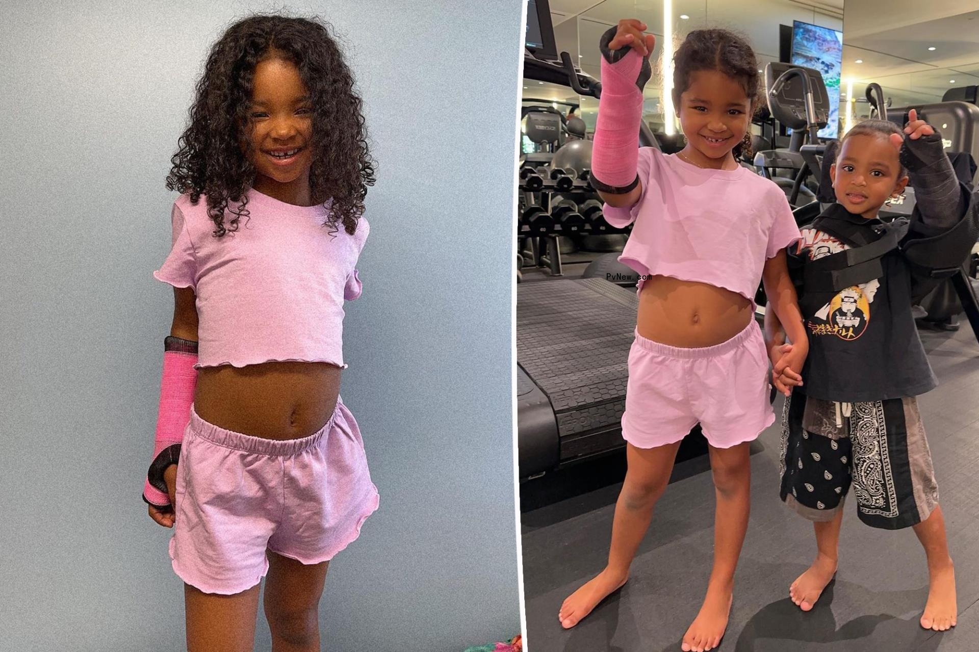 Khloé Kardashian reveals True, Psalm’s apparent broken arms 1 day after Kim’s own injury