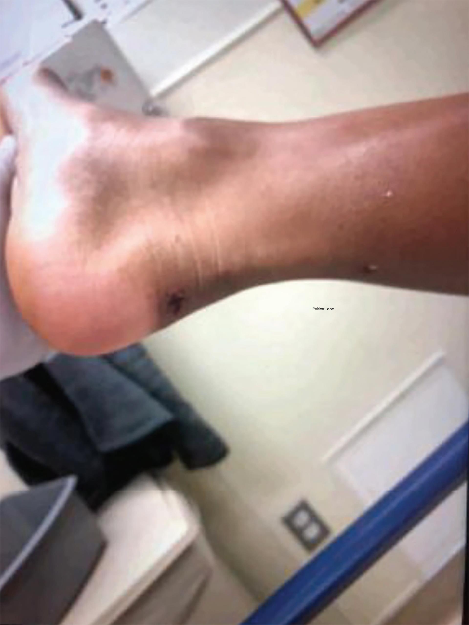 Megan Thee Stallion foot.
