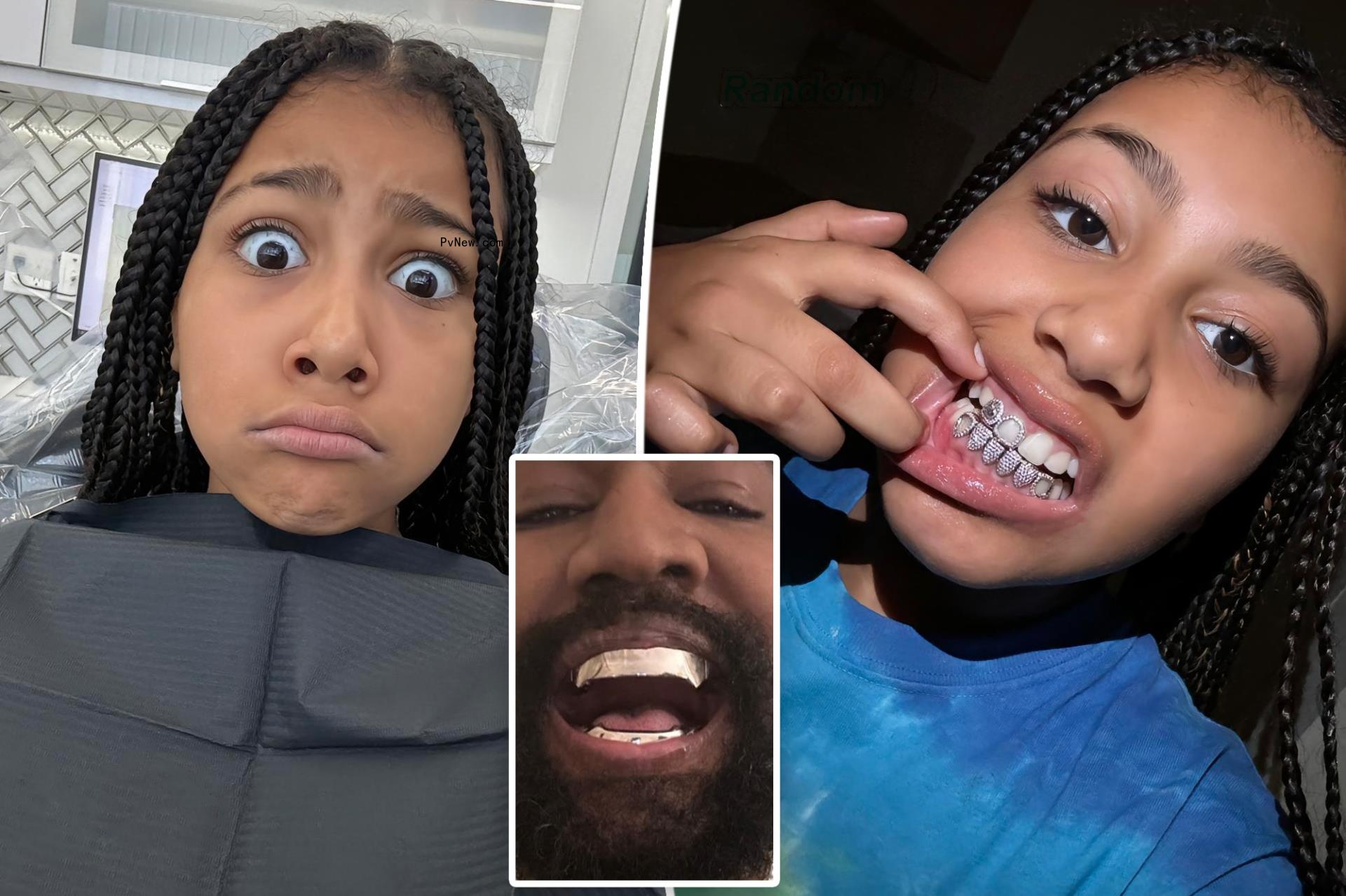 North West, 10, shows off diamond grills as dad Kanye debuts $850K titanium teeth
