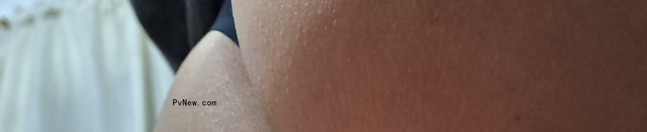 Micoldyy