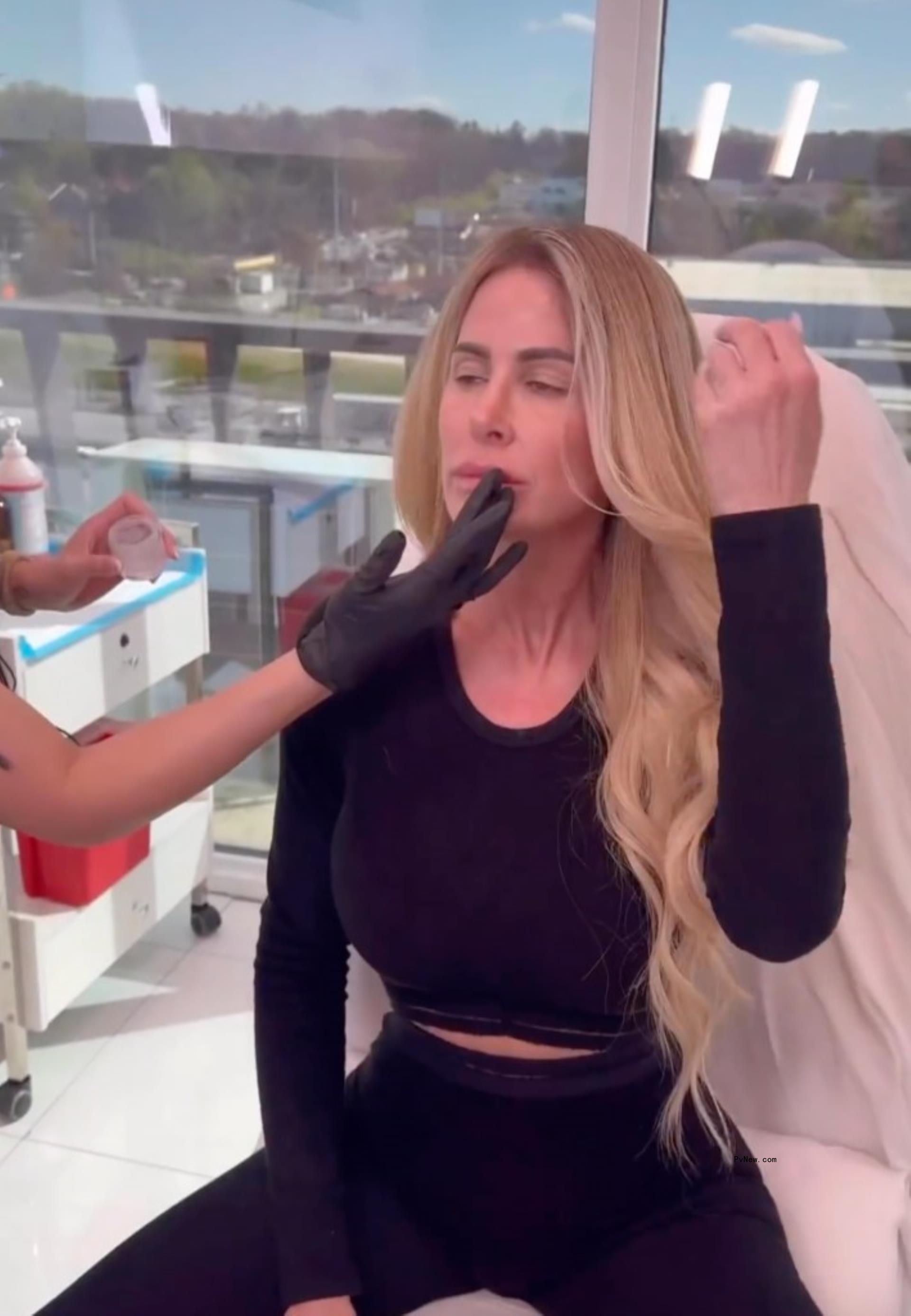 Kim Zolciak getting Botox and lip injections