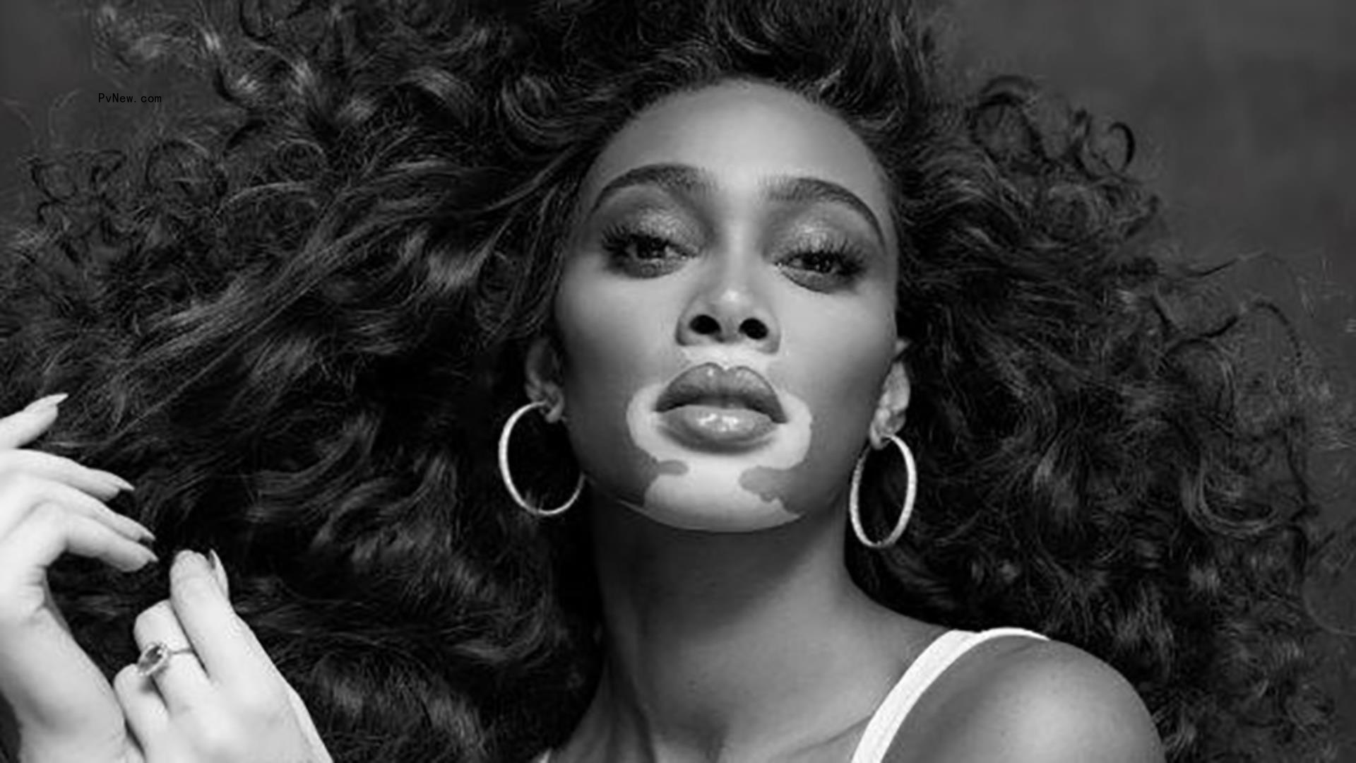 Winnie Harlow Signs With WME