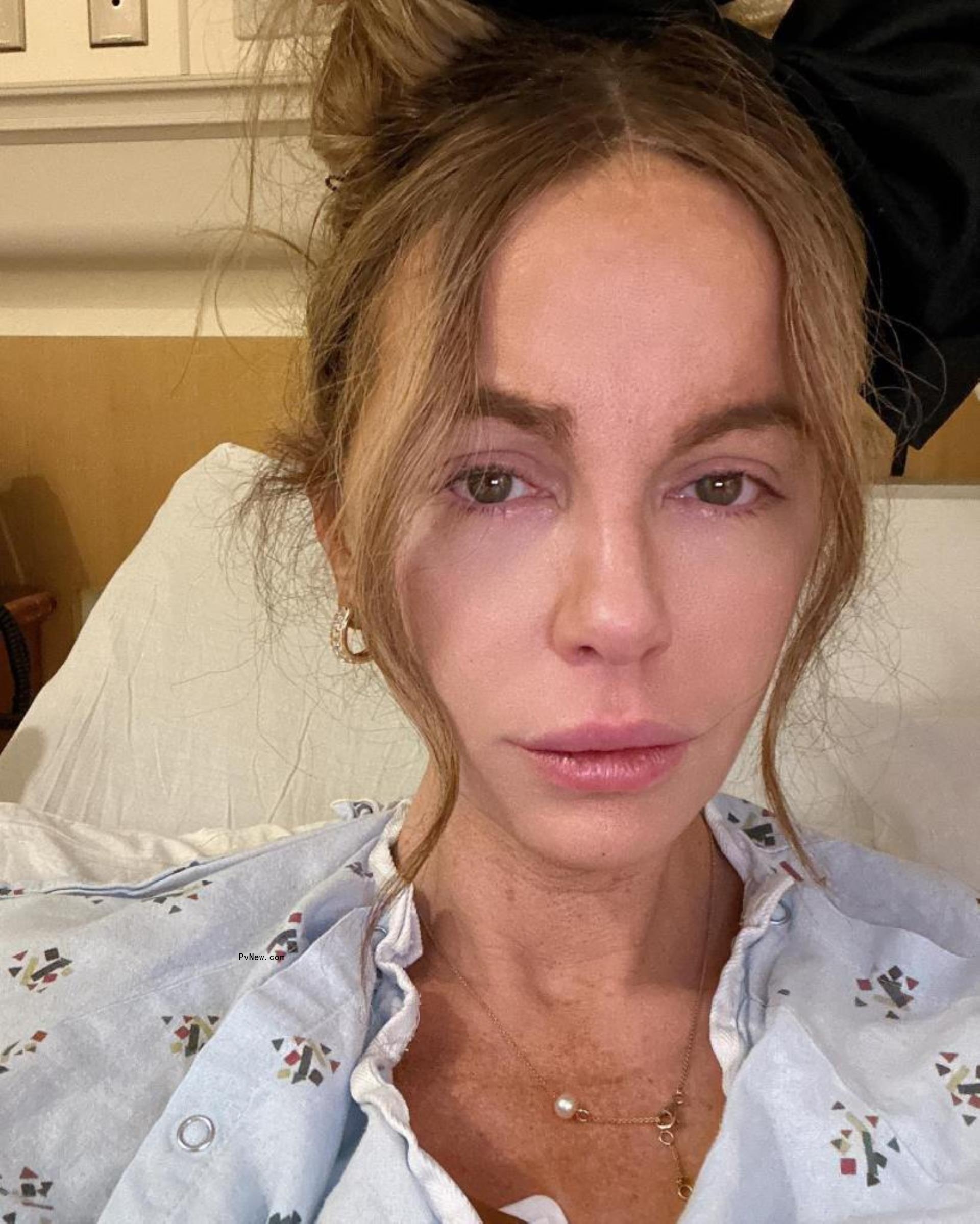 Kate Beckinsale selfie in hospital bed.