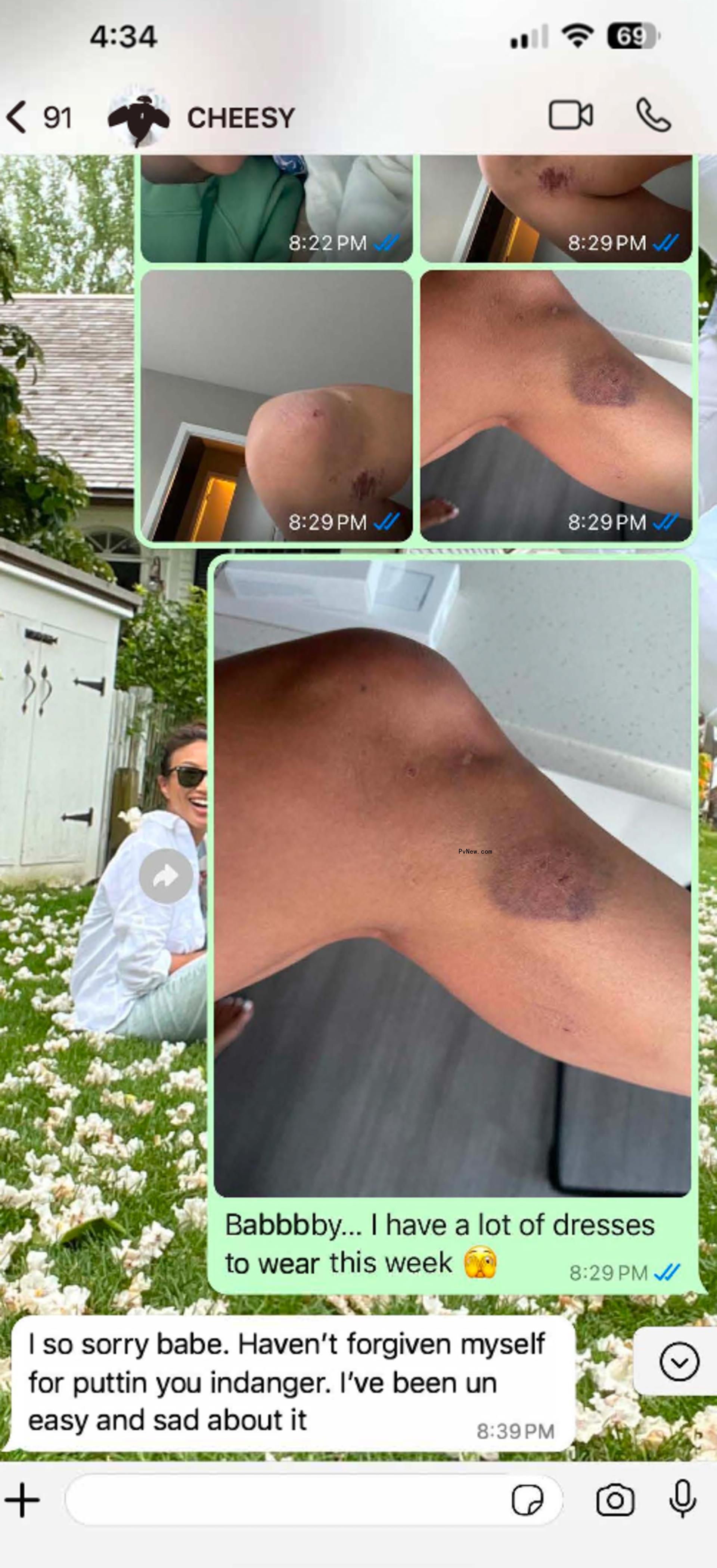 Jeannie Mai's bruises and texts.