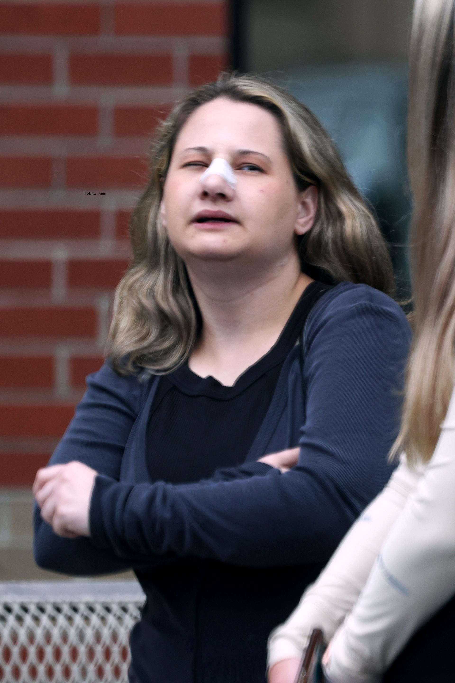 Gypsy Rose Blanchard nose job
