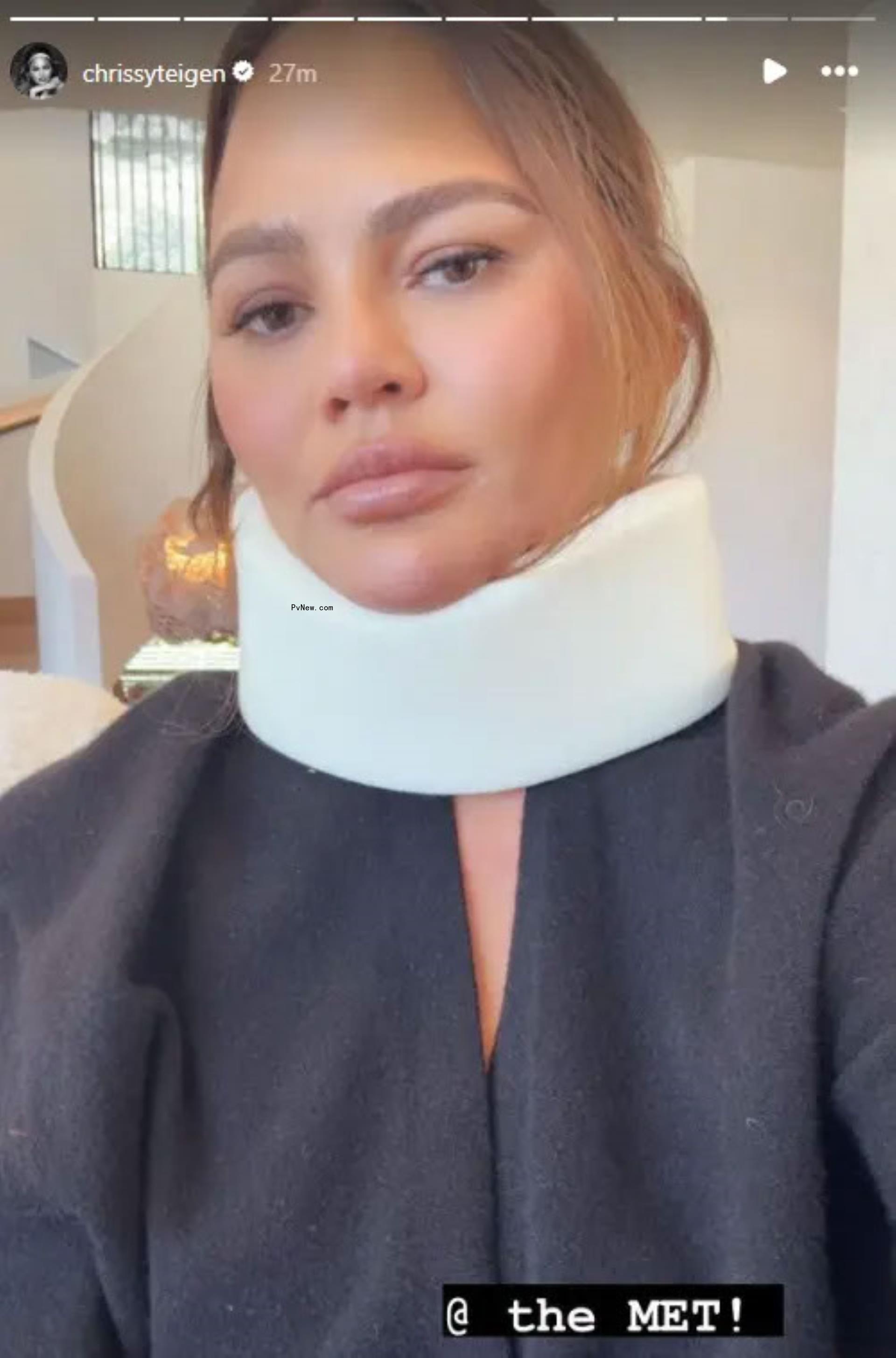 Chrissy Teigen