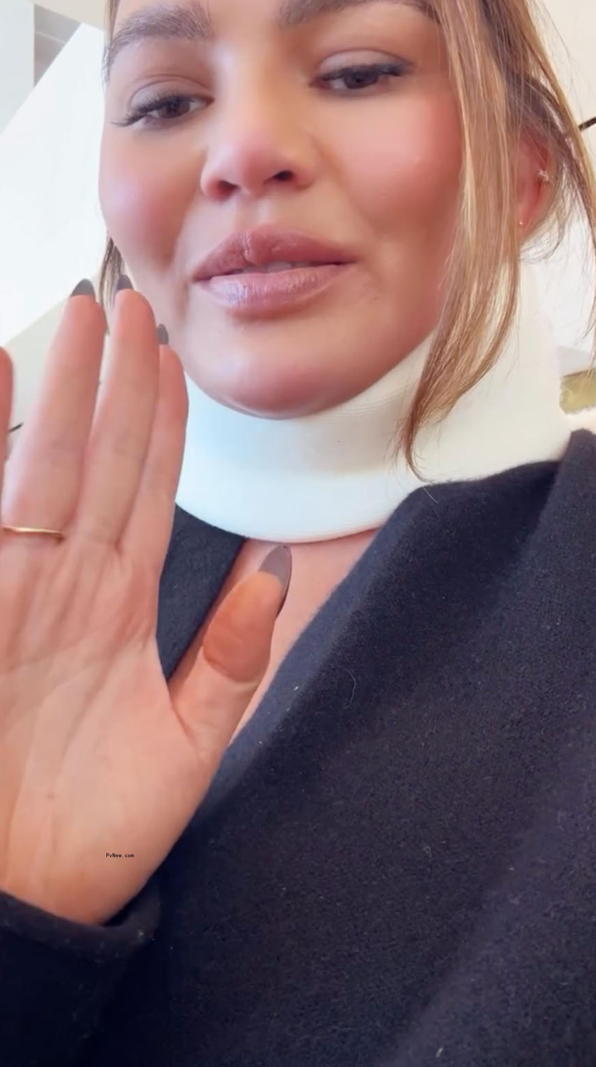 Chrissy Teigen
