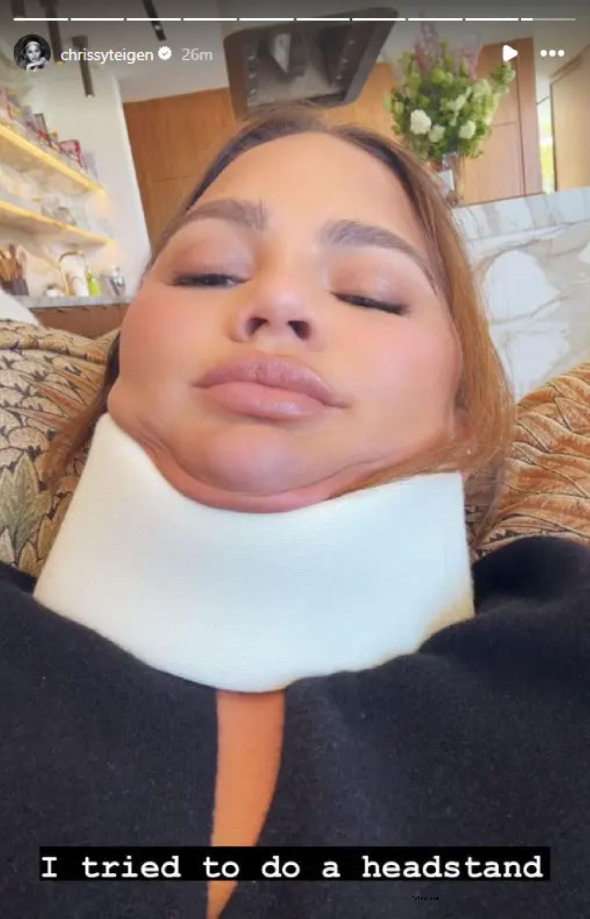Chrissy Teigen
