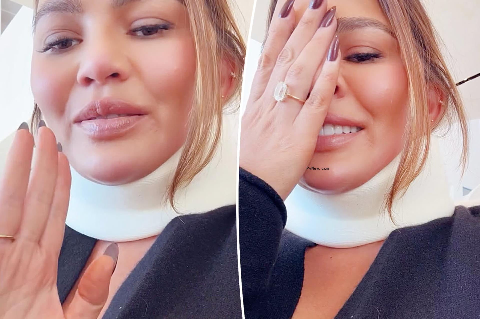 Chrissy Teigen