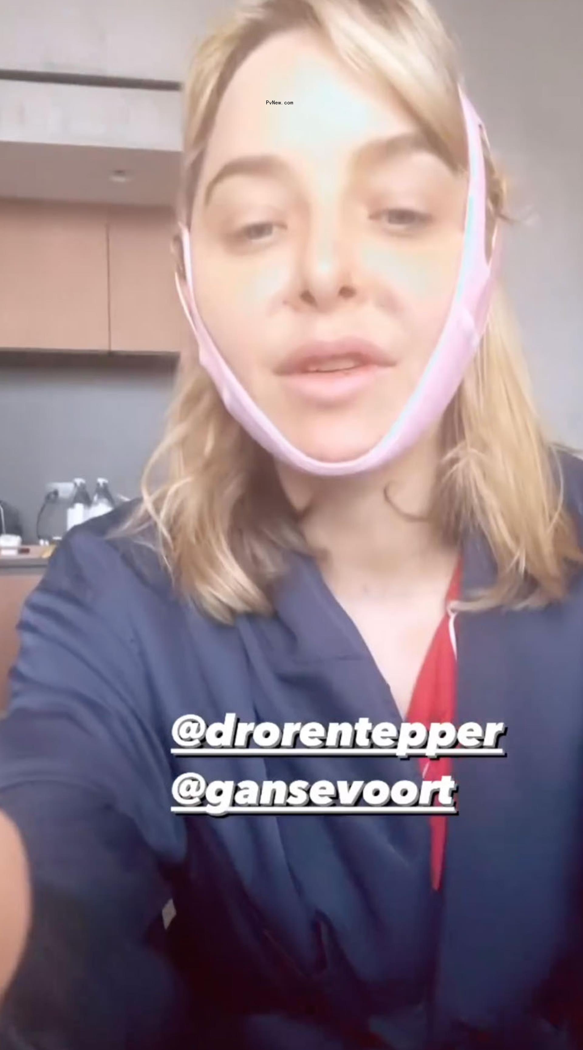 selfie of jenny mollen after plastic surgery