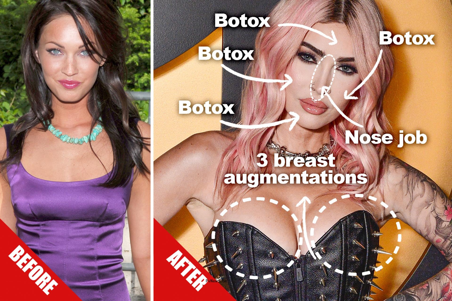 Megan Fox details the exact plastic surgery she’s had — and what she wants: 3 breast augmentations, nose job, more