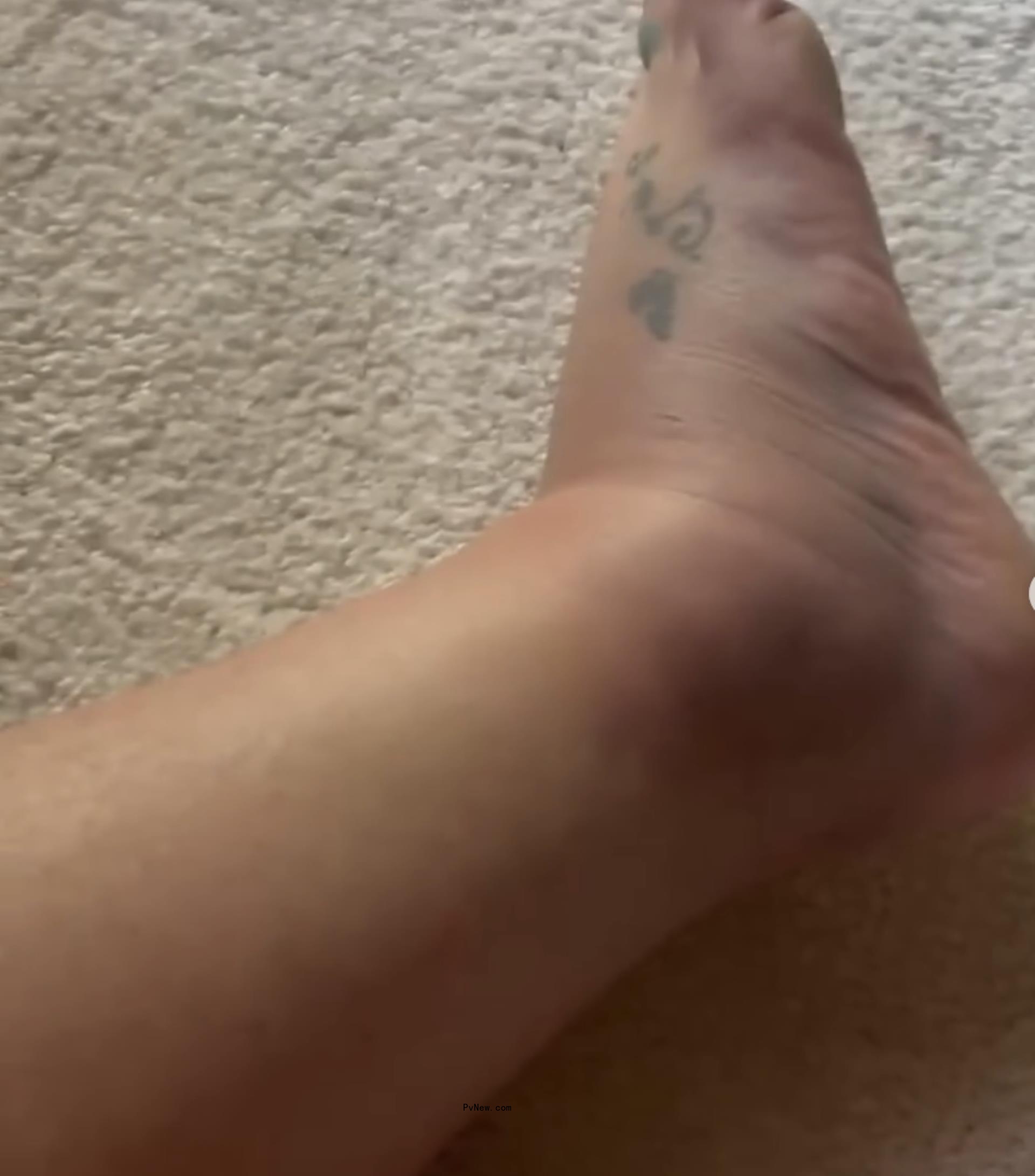 Britney Spears' broken foot