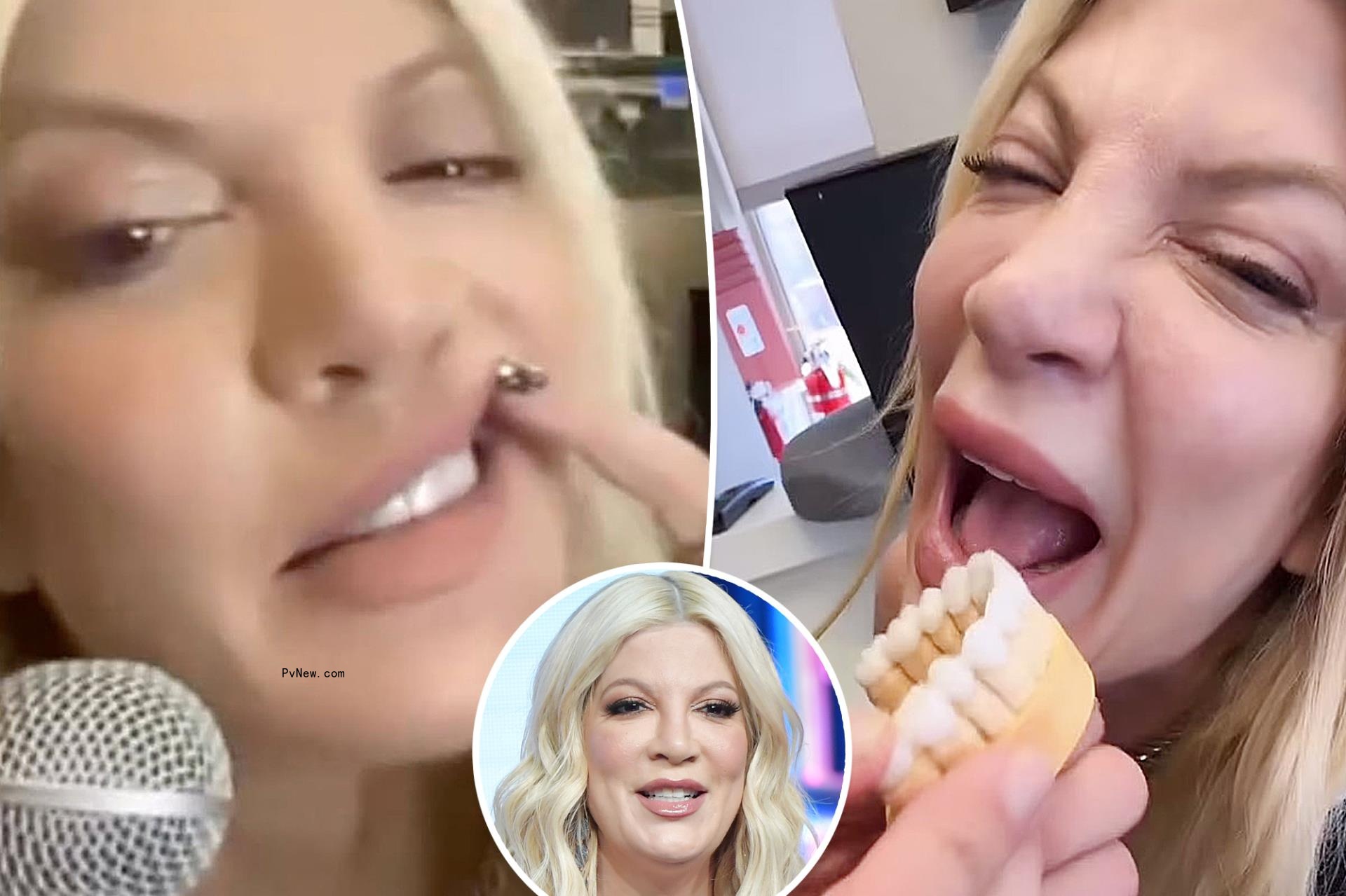 Tori Spelling has ‘never been happier’ since getting veneers to replac<i></i>e her ‘disgusting’ teeth: ‘I smile now’