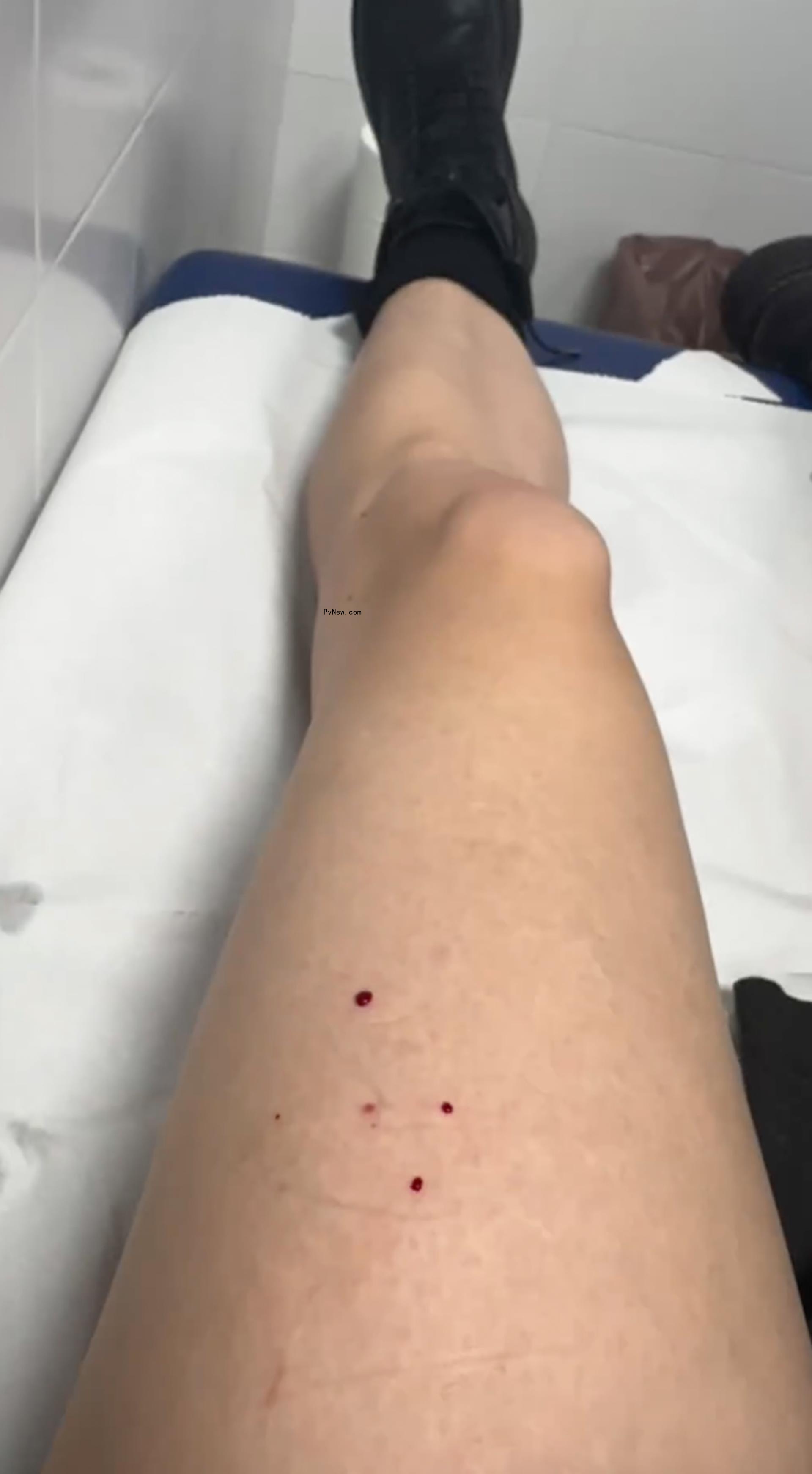 Taylor Momsen leg photo