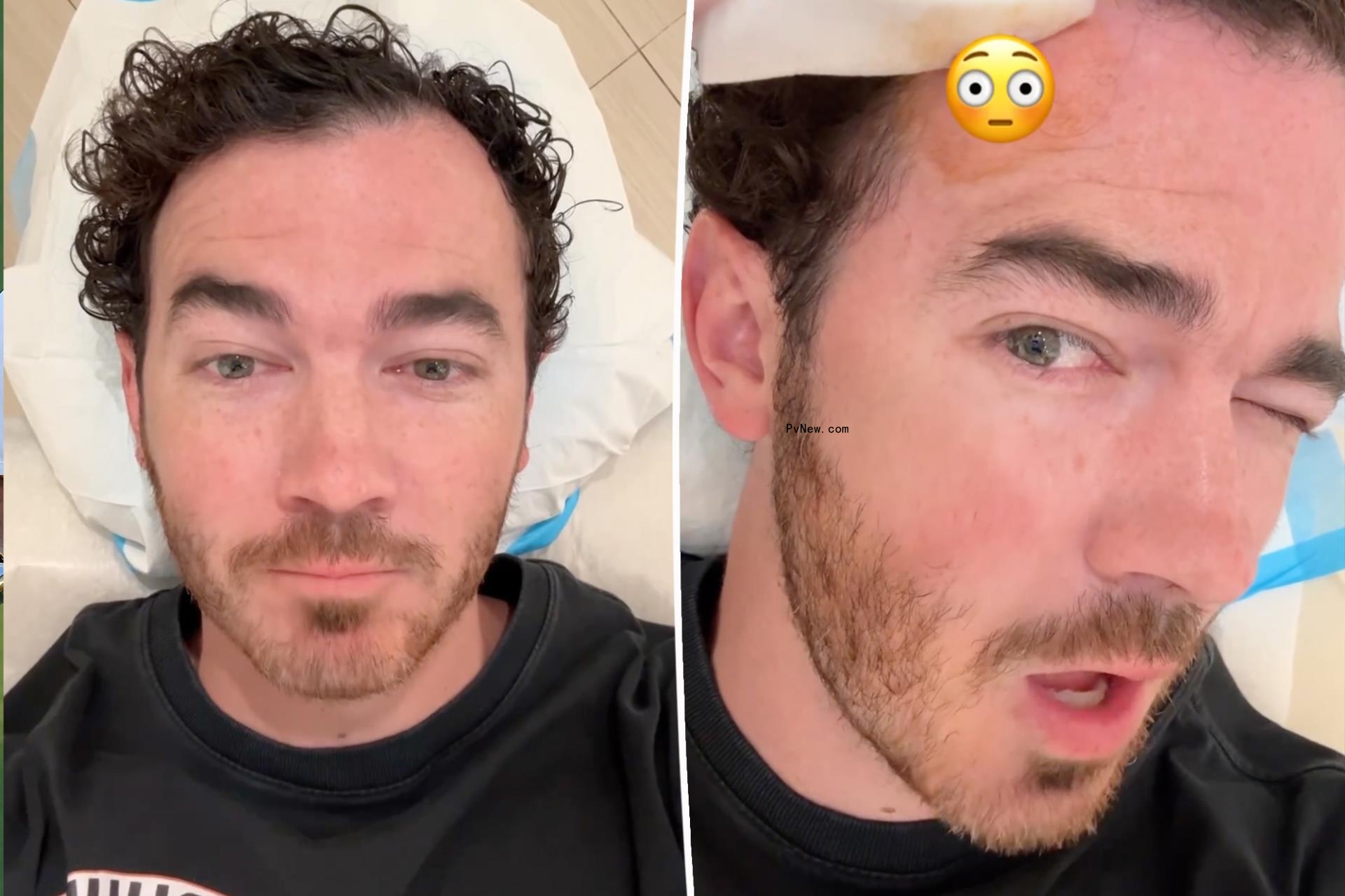 Kevin Jo<i></i>nas undergoes surgery to remove skin cancer: ‘Reminder to get your moles checked’
