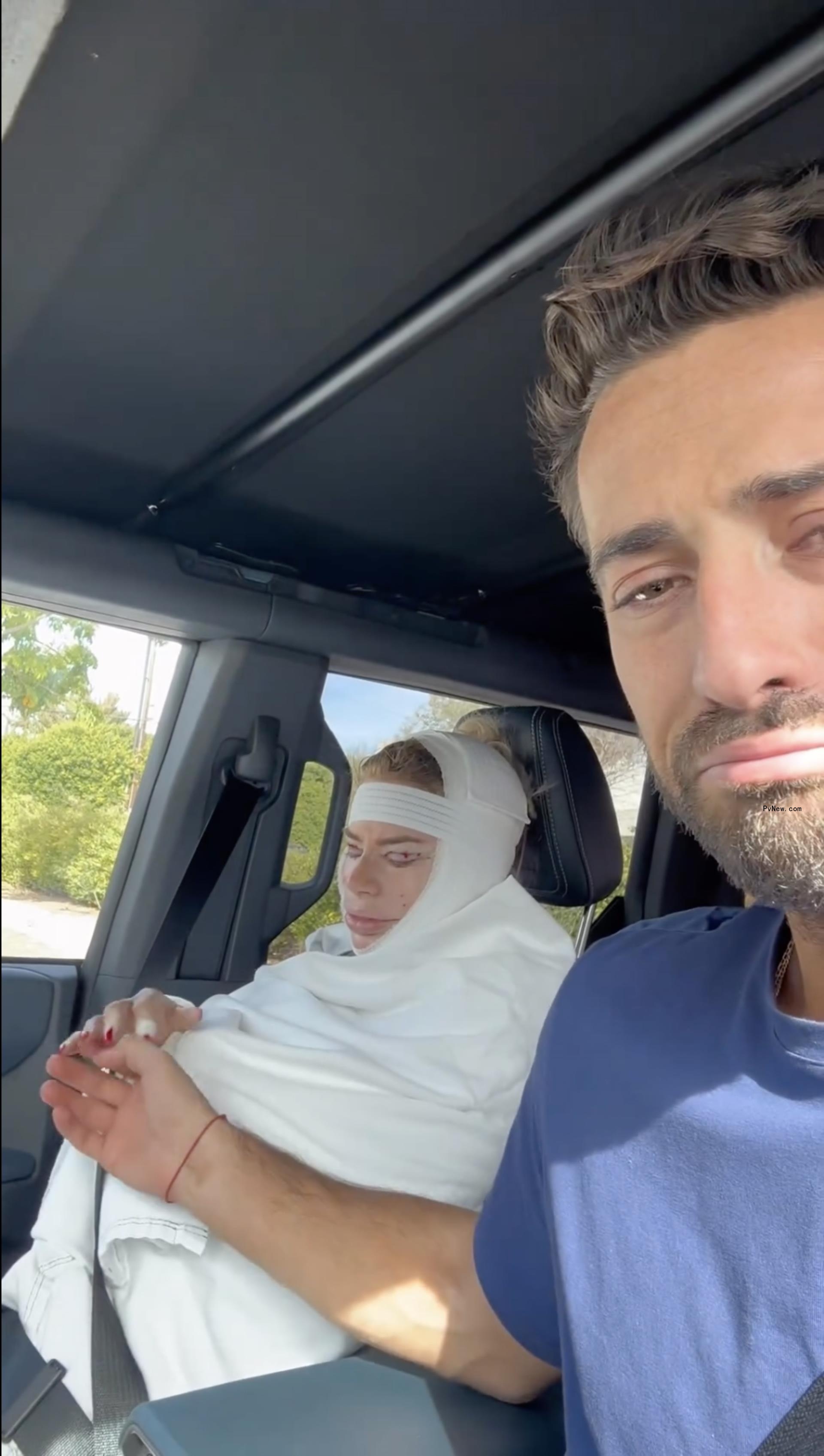 Caroline Stanbury's face in bandages with Sergio Carrallo sitting next to her