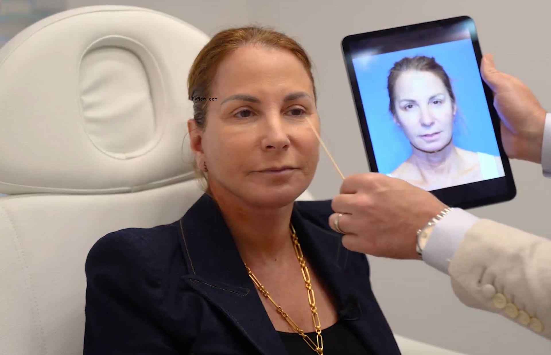 jill zarin next to an ipad of her face before surgery