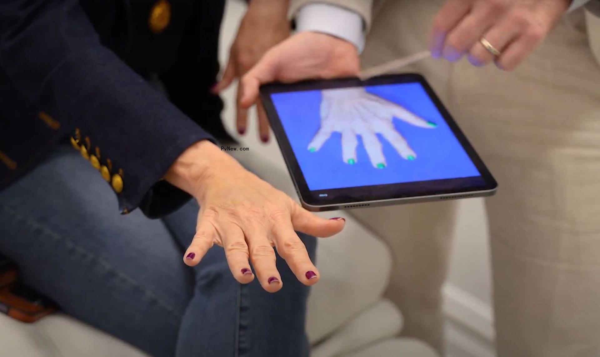 jill zarin's hand after surgery