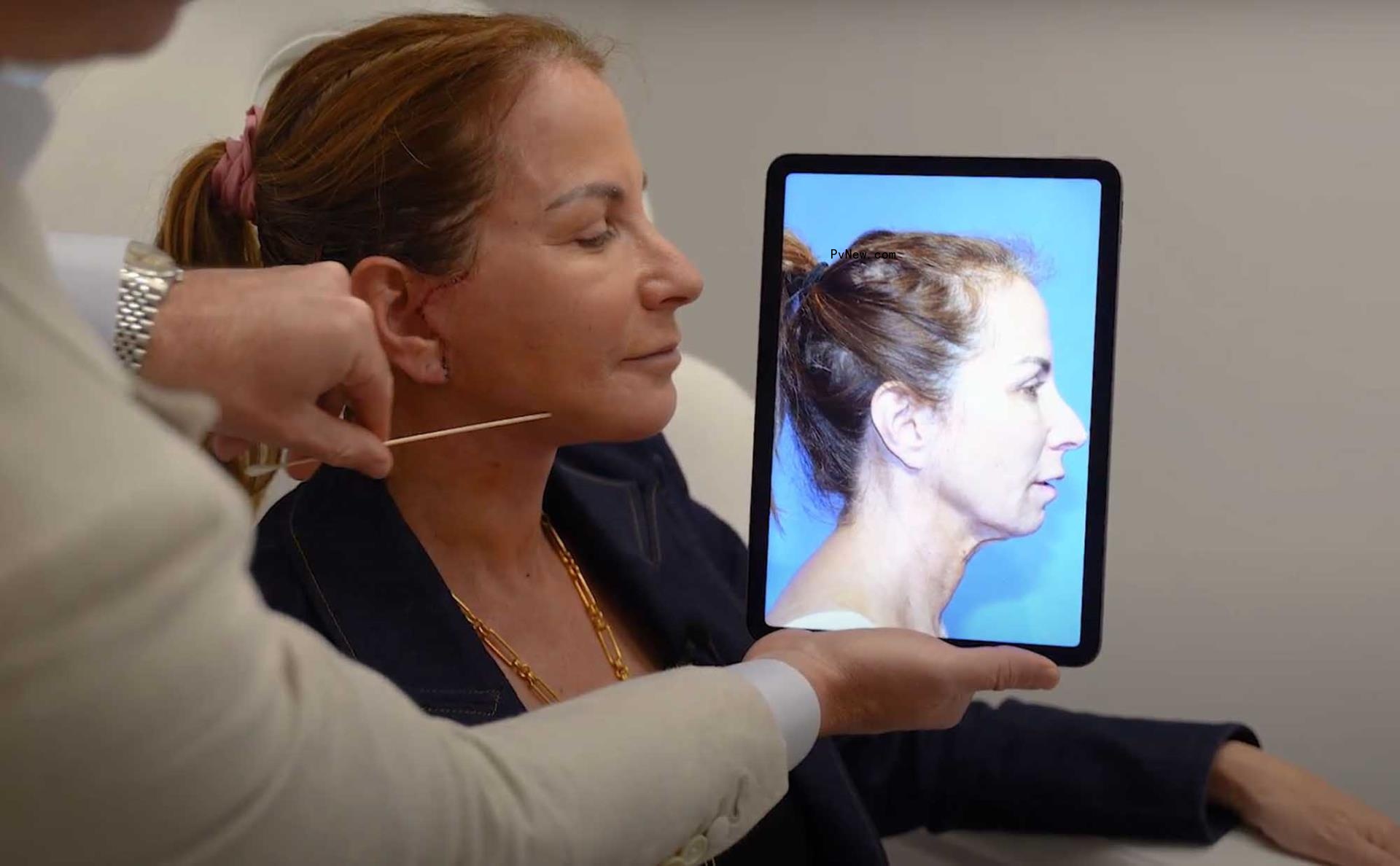 jill zarin's profile next to an ipad with a photo of her old face