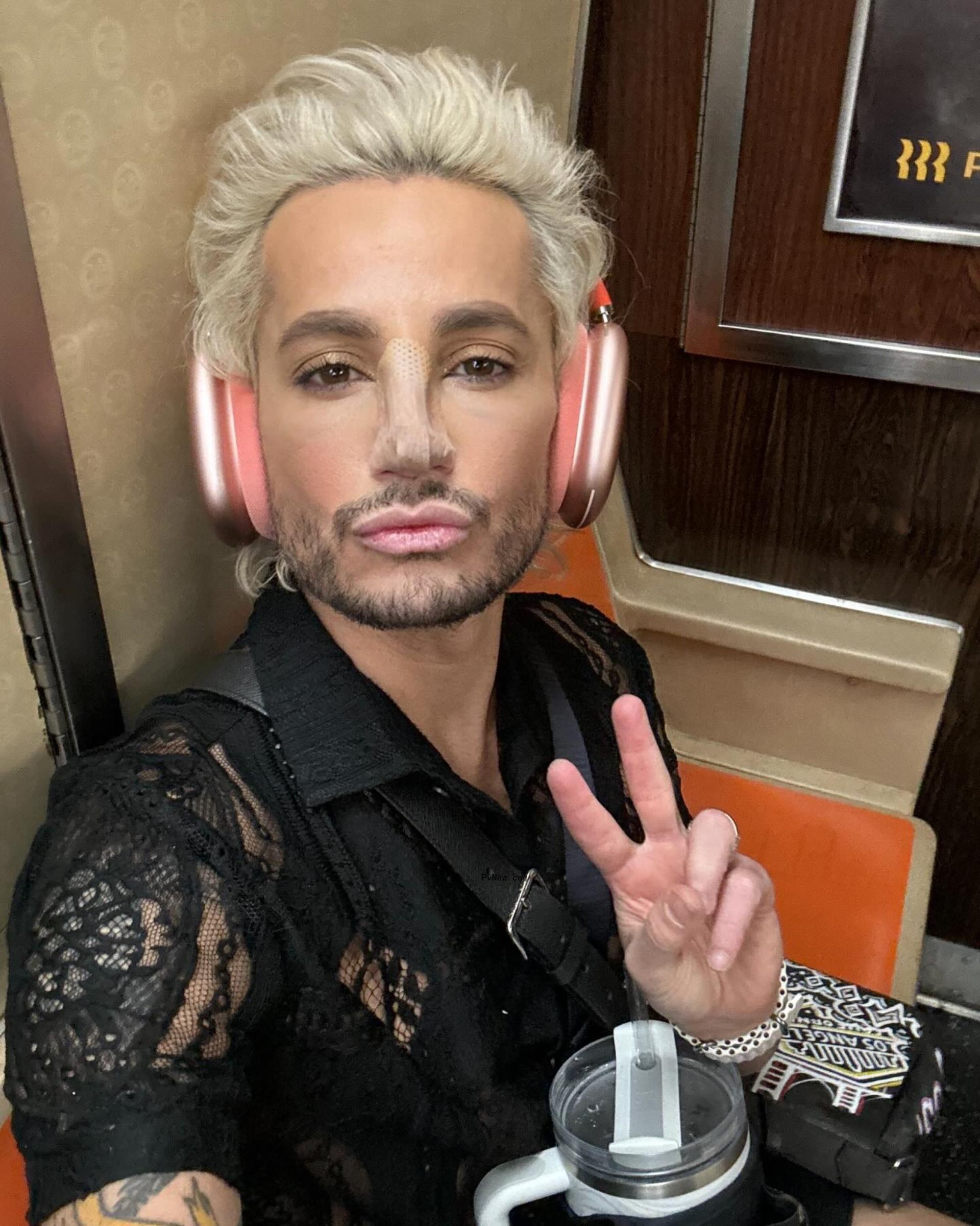 A selfie of Frankie Grande after his nose job