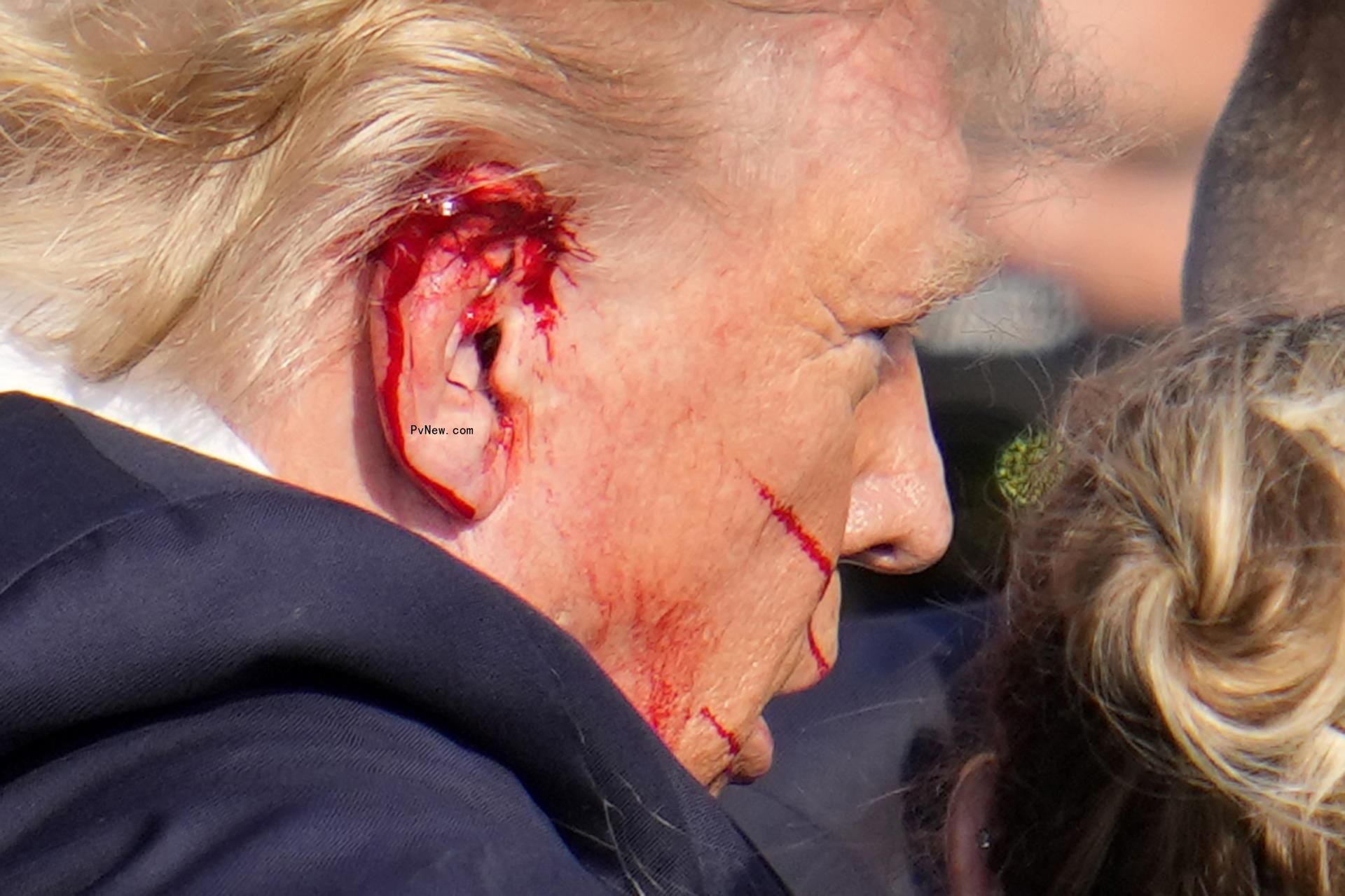 Do<i></i>nald Trump bleeding at Pennsylvania rally