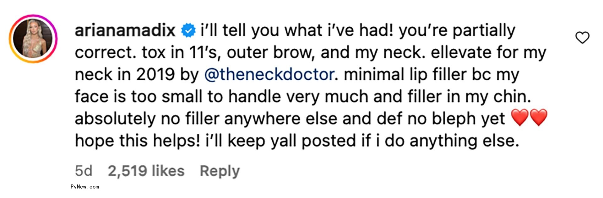 Ariana Madix's respo<i></i>nse a<i></i>bout her cosmetic work. 