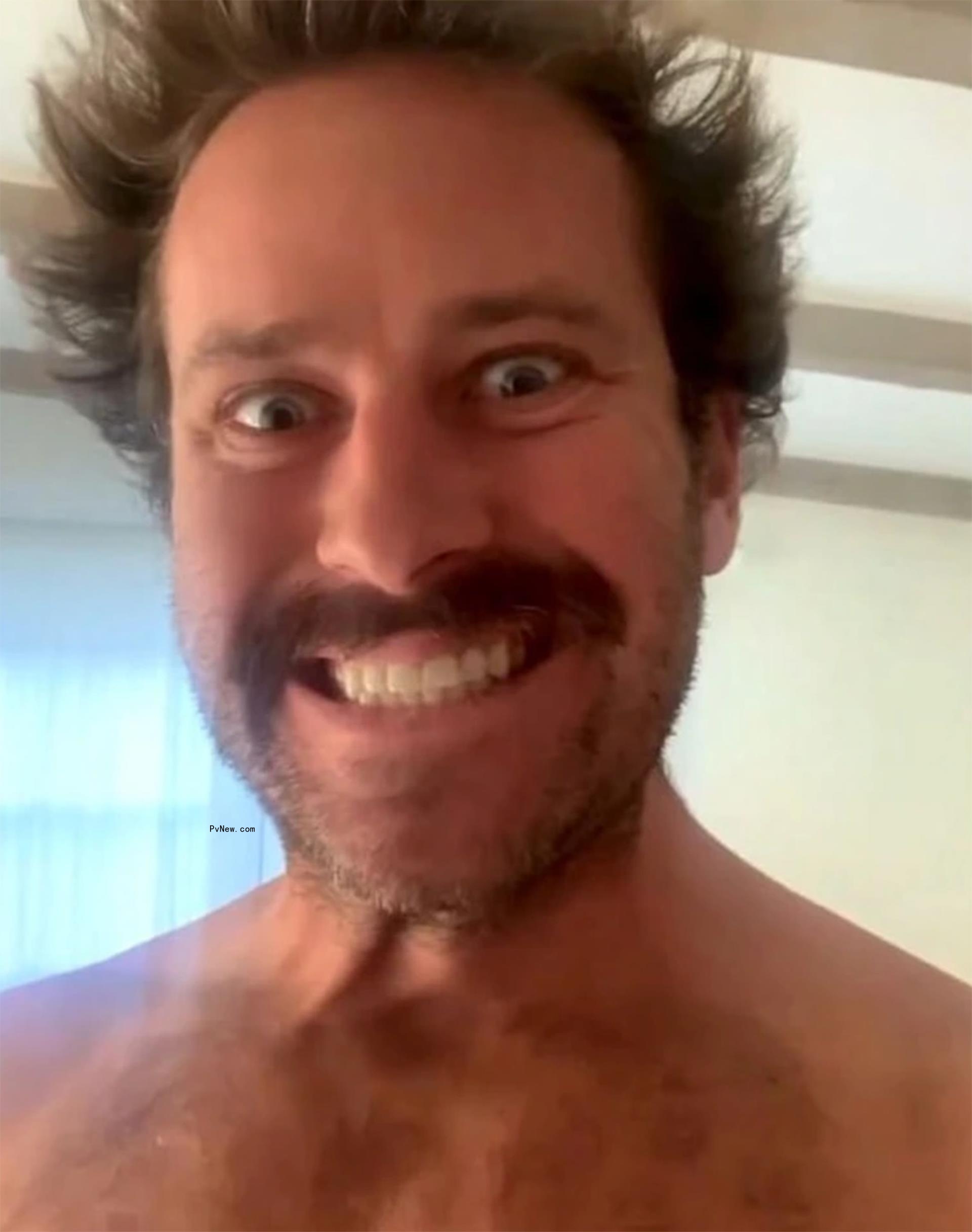 Armie Hammer