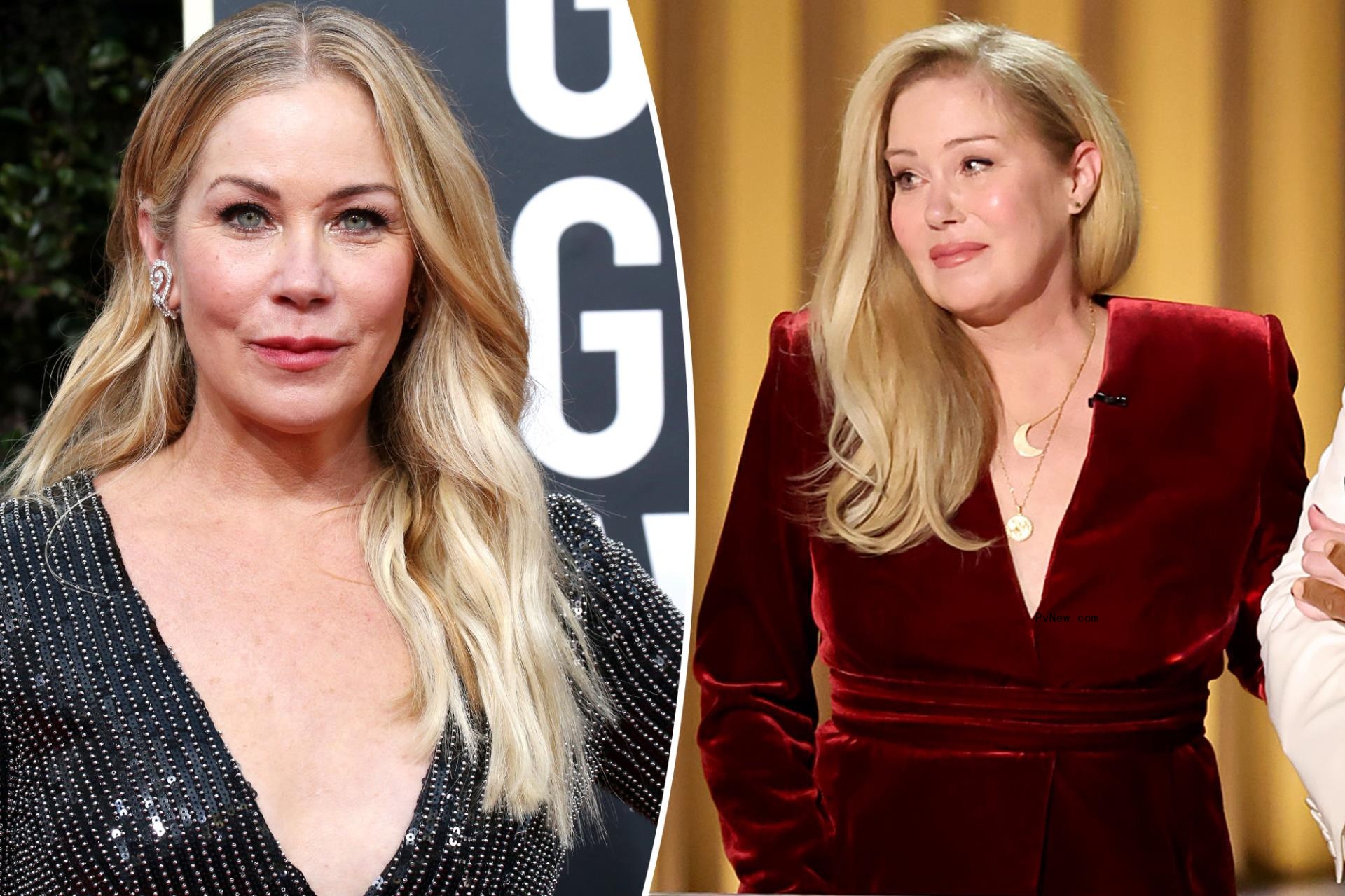 Christina Applegate reveals ‘o<i></i>nly plastic surgery’ she’s ever had after producer’s comment
