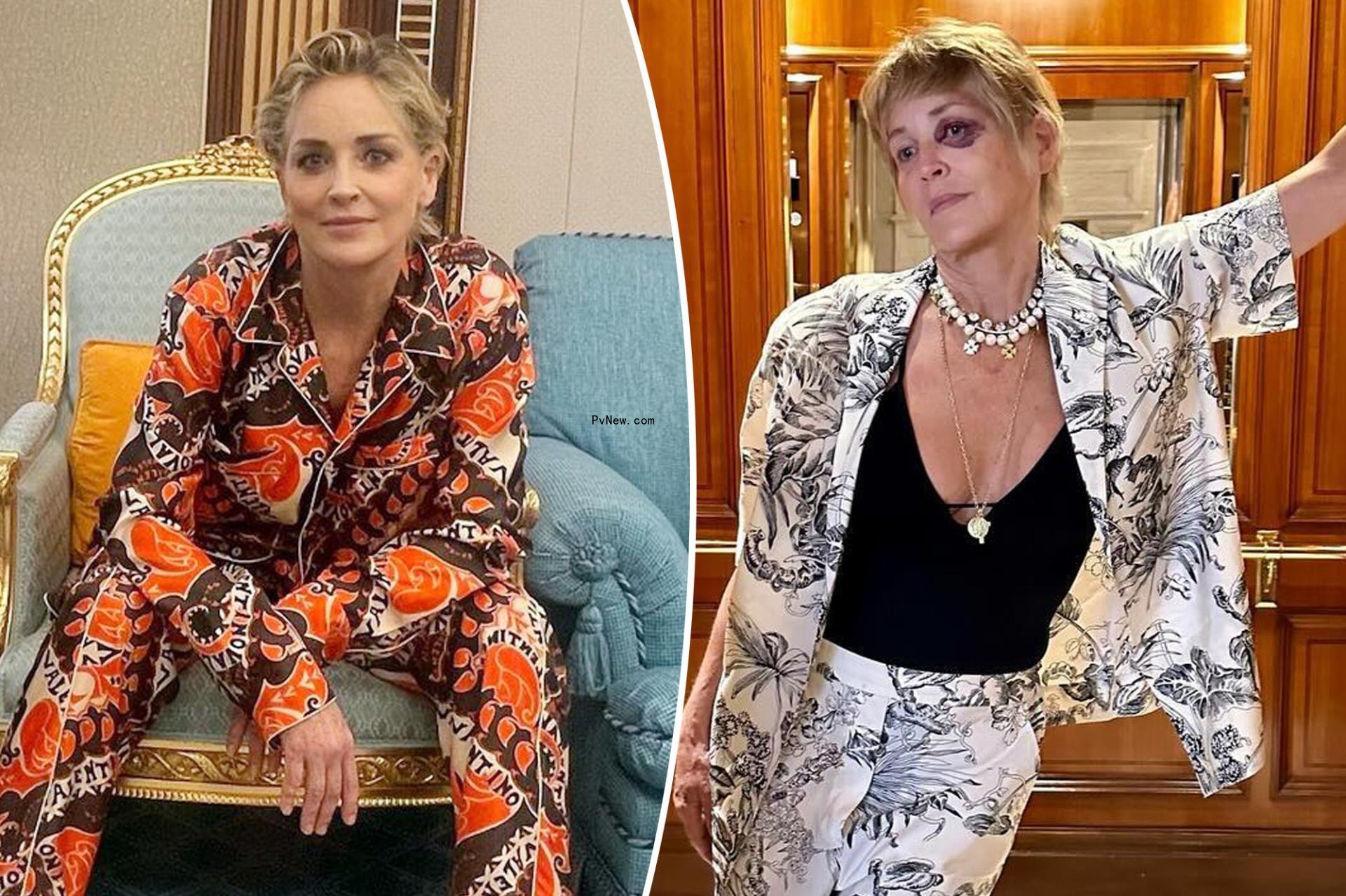Sharon Stone shows off mystery black eye during vacation to Turkey: ‘This trip has been tough’