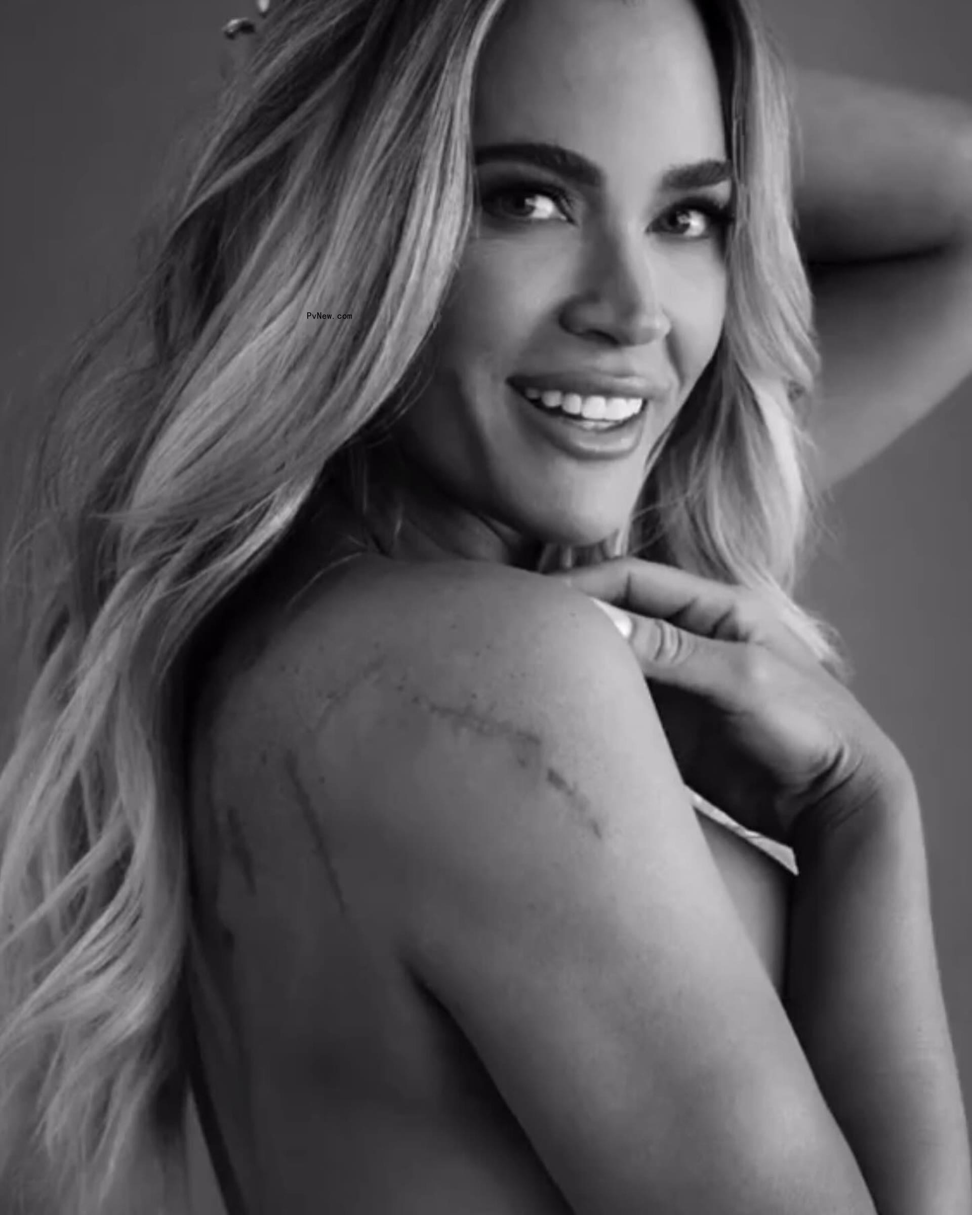 shirtless teddi mellencamp with scars on her back smiling in black-and-white photo