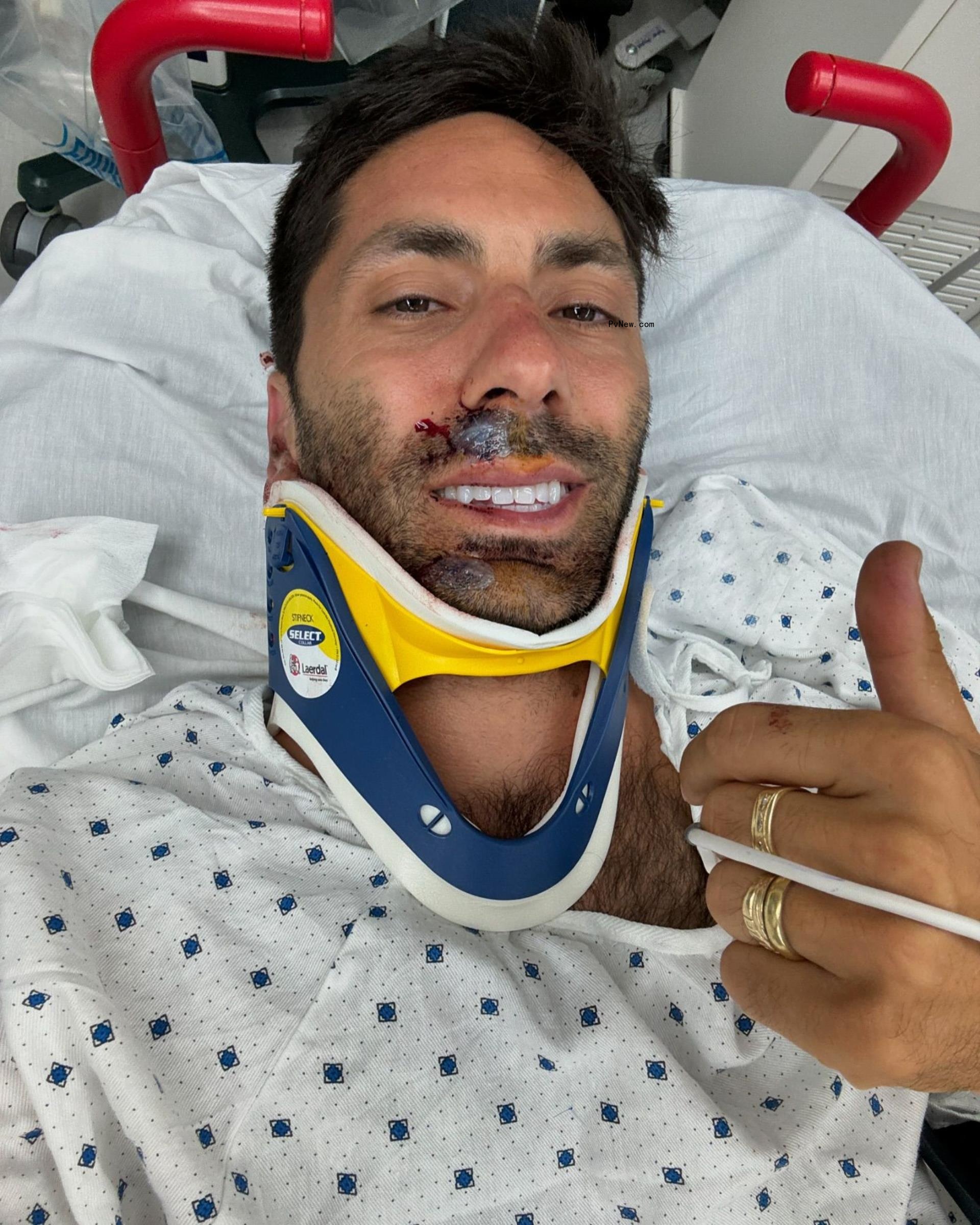 A selfie of Nev Schulman in the hospital.