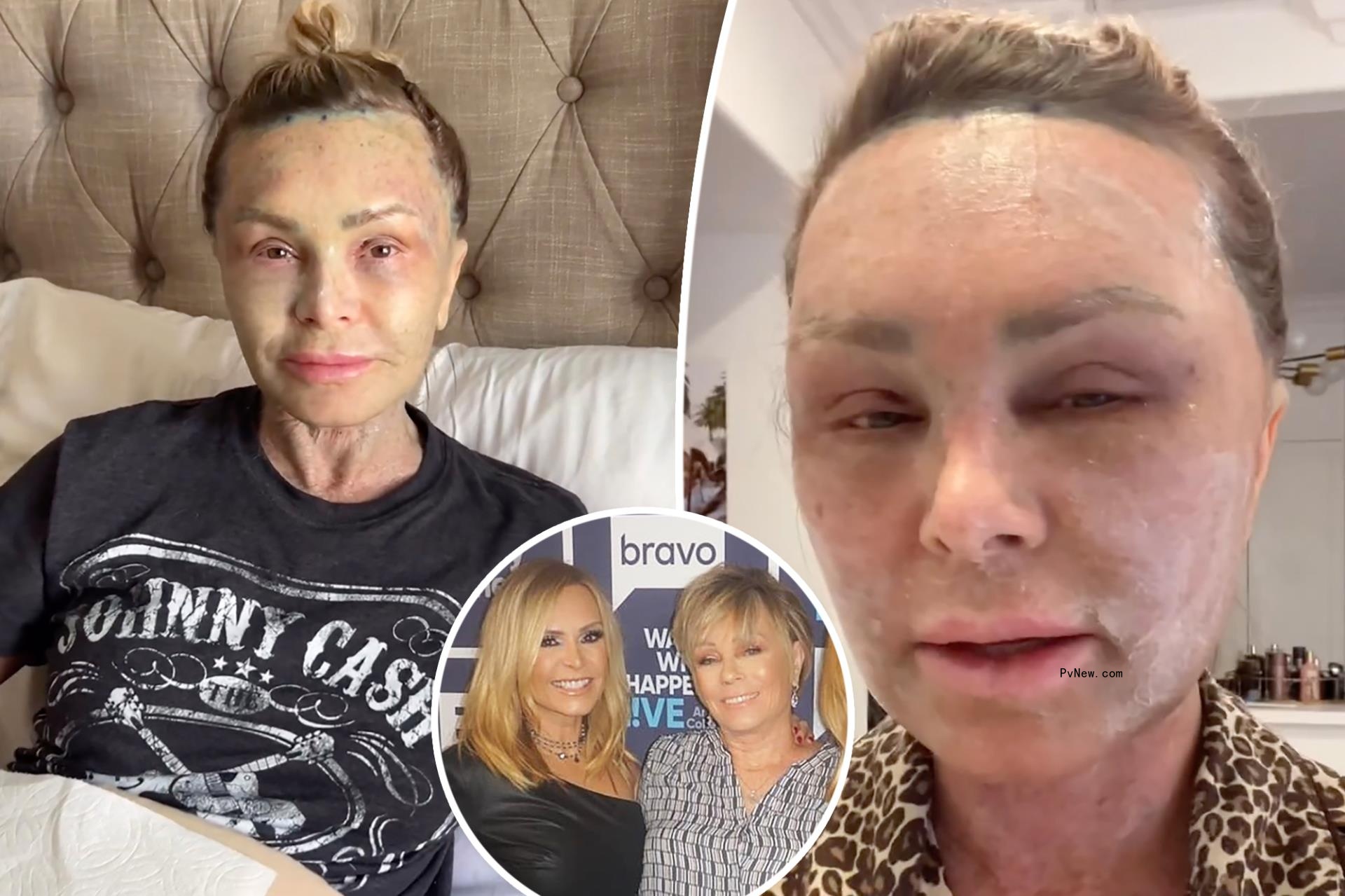 Tamra Judge savagely roasted by mom over plastic surgery recovery: ‘Your face literally makes me want to throw up’